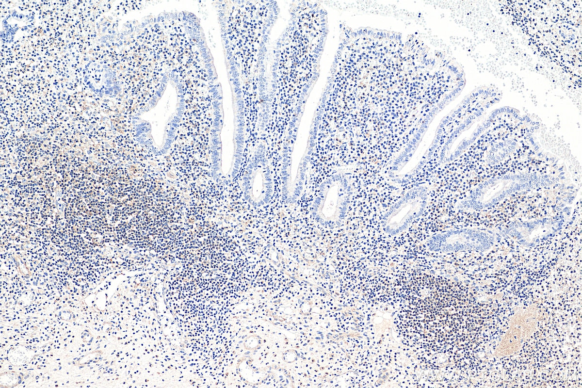 Immunohistochemistry (IHC) staining of human appendicitis tissue using CD100 Monoclonal antibody (66582-1-Ig)