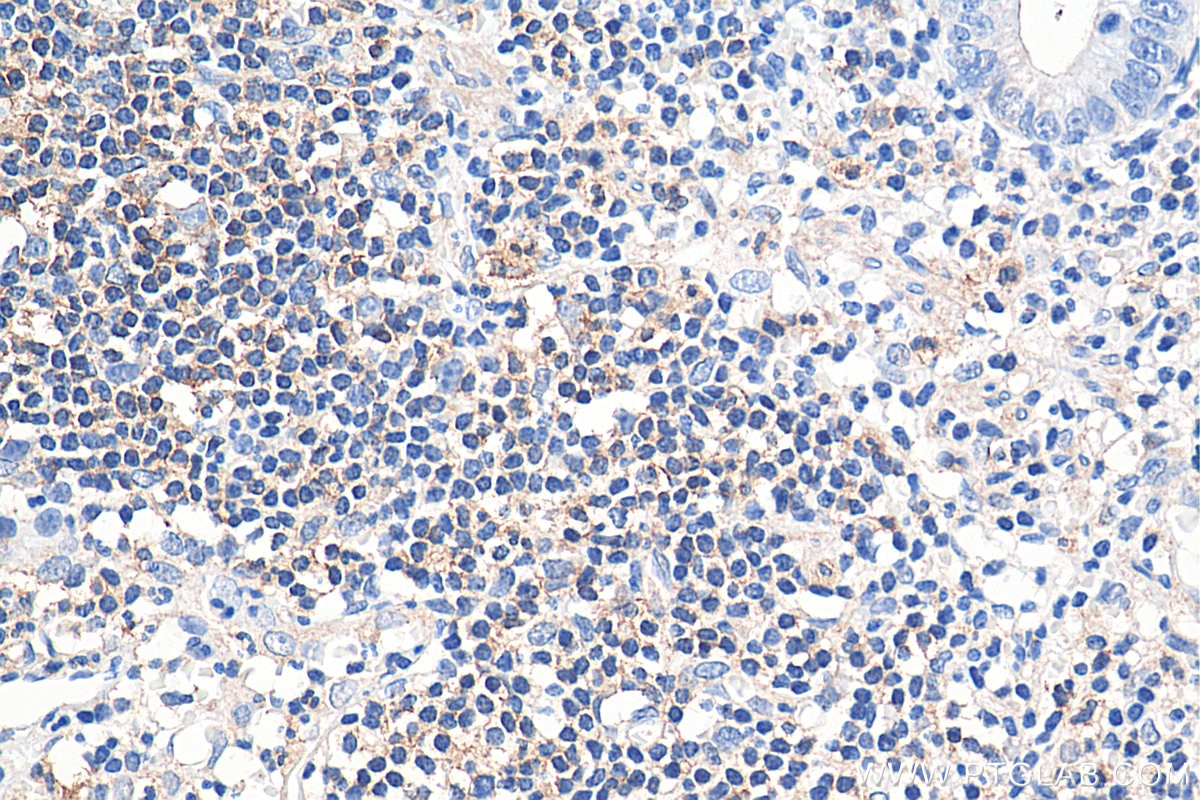 Immunohistochemistry (IHC) staining of human appendicitis tissue using CD100 Monoclonal antibody (66582-1-Ig)