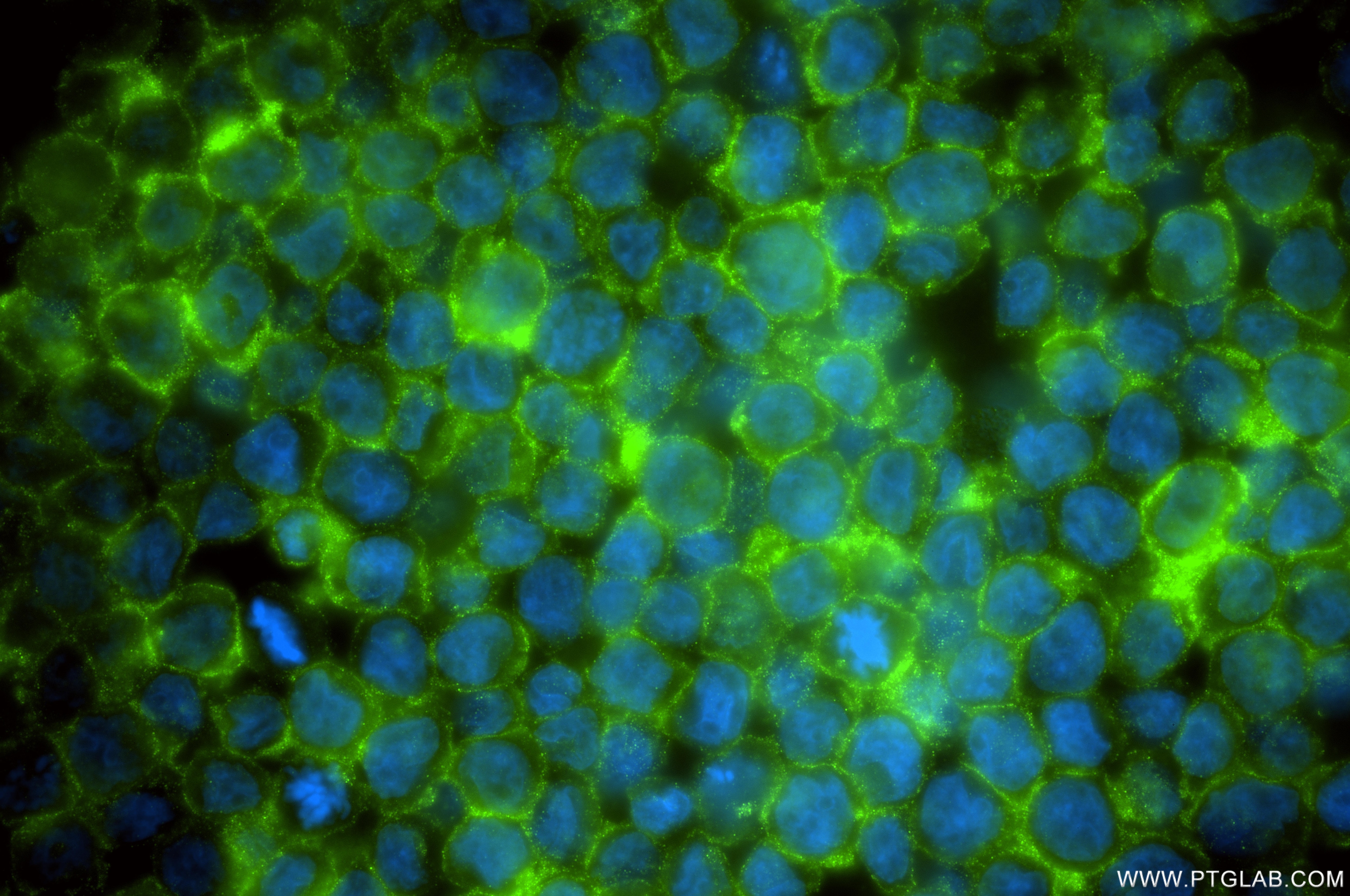 Immunofluorescence (IF) / fluorescent staining of THP-1 cells using CD100 Recombinant monoclonal antibody (84465-9-RR)