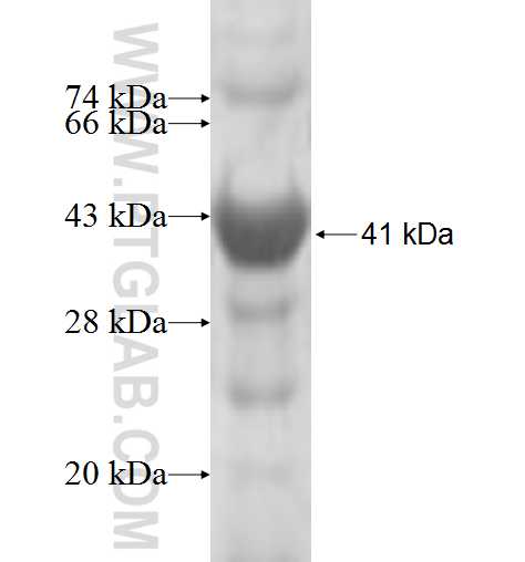CD100 fusion protein Ag6285 SDS-PAGE