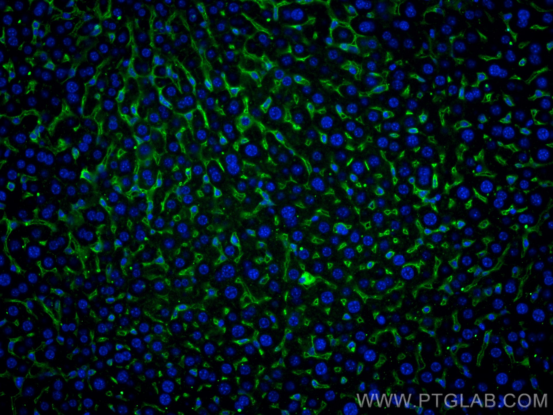 Immunofluorescence (IF) / fluorescent staining of mouse liver tissue using Anti-Mouse Endoglin/CD105 (MJ7/18) (65048-1-Ig)