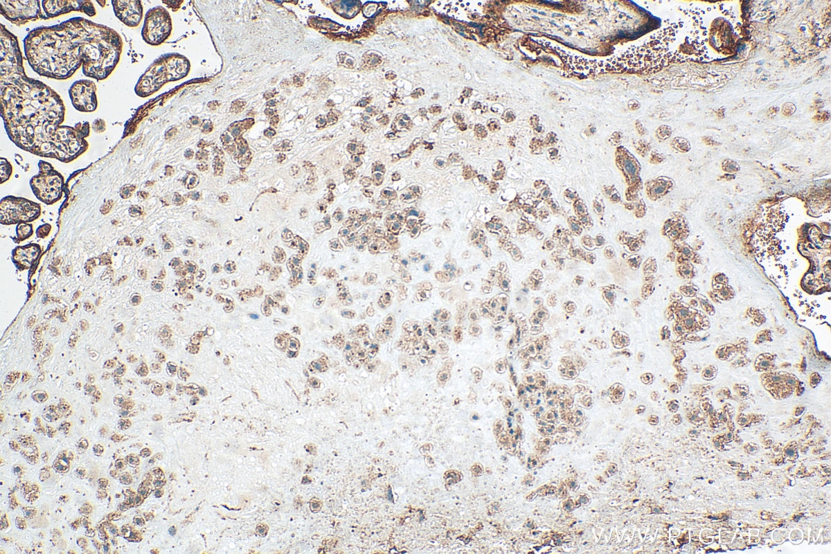 IHC staining of human placenta using 21997-1-AP