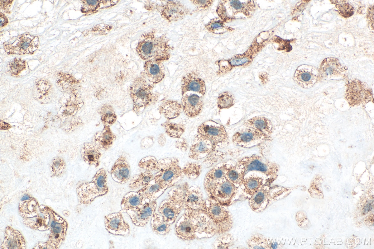 Immunohistochemistry (IHC) staining of human placenta tissue using CD107a / LAMP1 Polyclonal antibody (21997-1-AP)