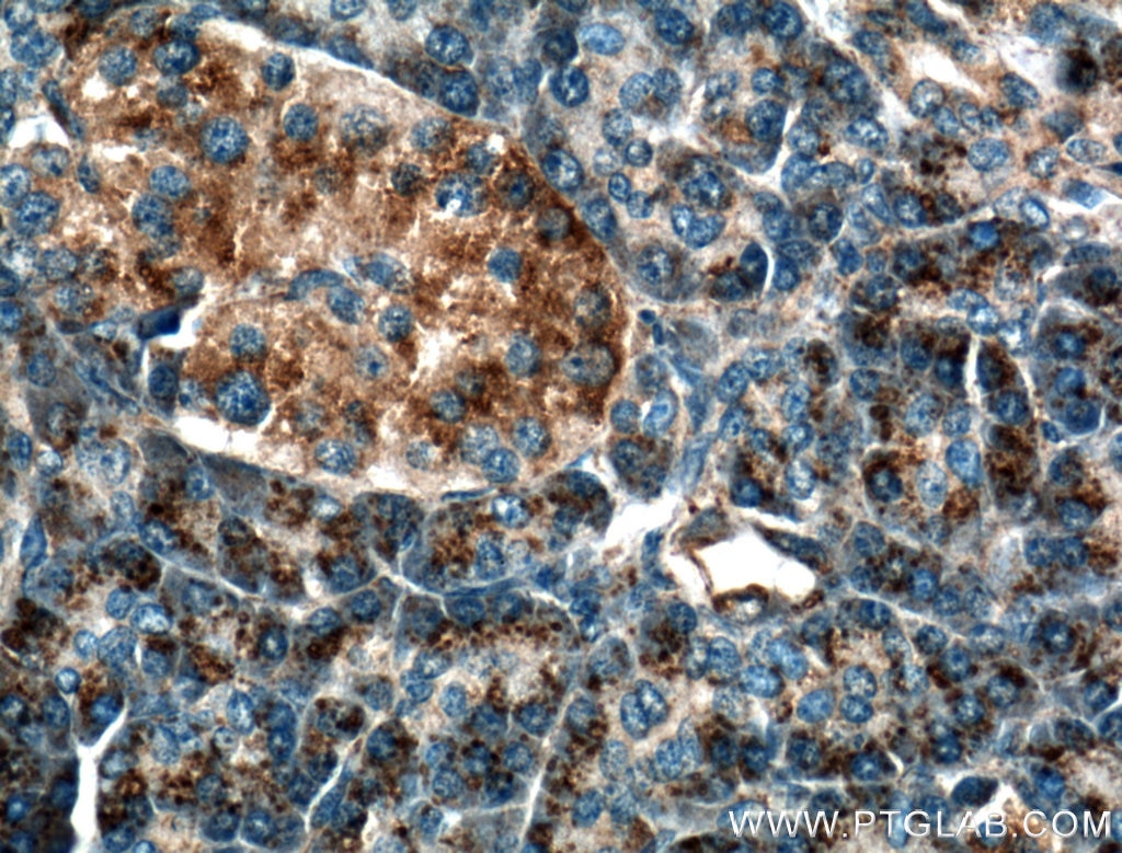 Immunohistochemistry (IHC) staining of human pancreas tissue using CD107a / LAMP1 Polyclonal antibody (21997-1-AP)