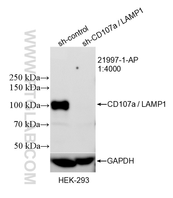 WB result of CD107a / LAMP1 antibody (21997-1-AP; 1:4000; incubated at room temperature for 1.5 hours) with sh-Control and sh-CD107a / LAMP1 transfected HEK-293 cells. Western Blot (WB) analysis of HEK-293 cells using CD107a / LAMP1 Polyclonal antibody (21997-1-AP)