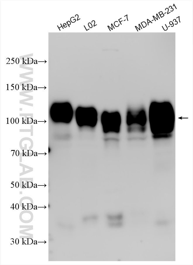 Western Blot (WB) analysis of various lysates using CD107a / LAMP1 Polyclonal antibody (21997-1-AP)