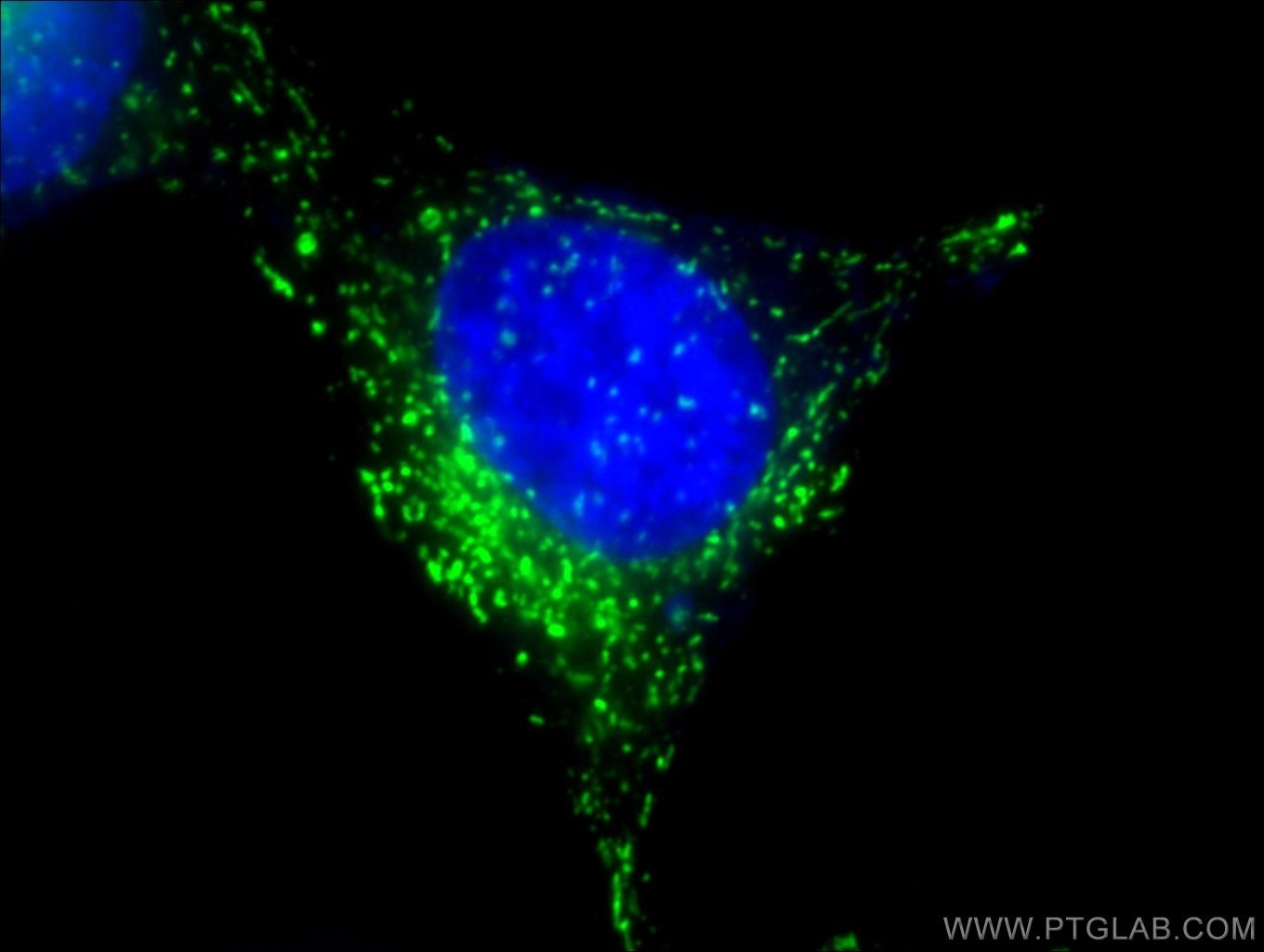 Immunofluorescence (IF) / fluorescent staining of HeLa cells using Anti-Human CD107a / LAMP1 (H4A3) (65051-1-Ig)