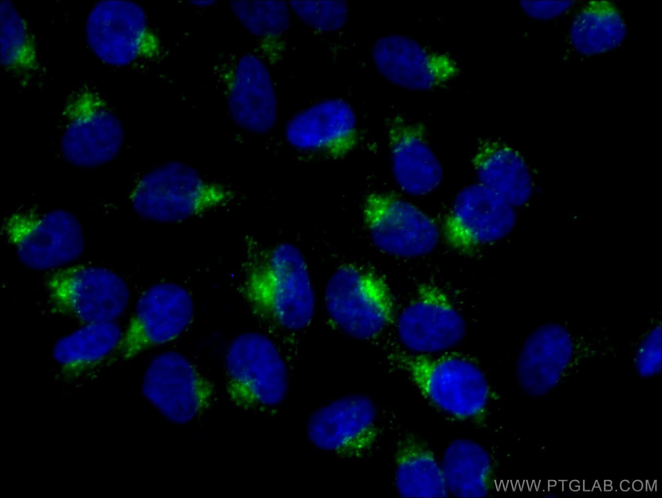 Immunofluorescence (IF) / fluorescent staining of HeLa cells using Anti-Human CD107a / LAMP1 (H4A3) (65051-1-Ig)