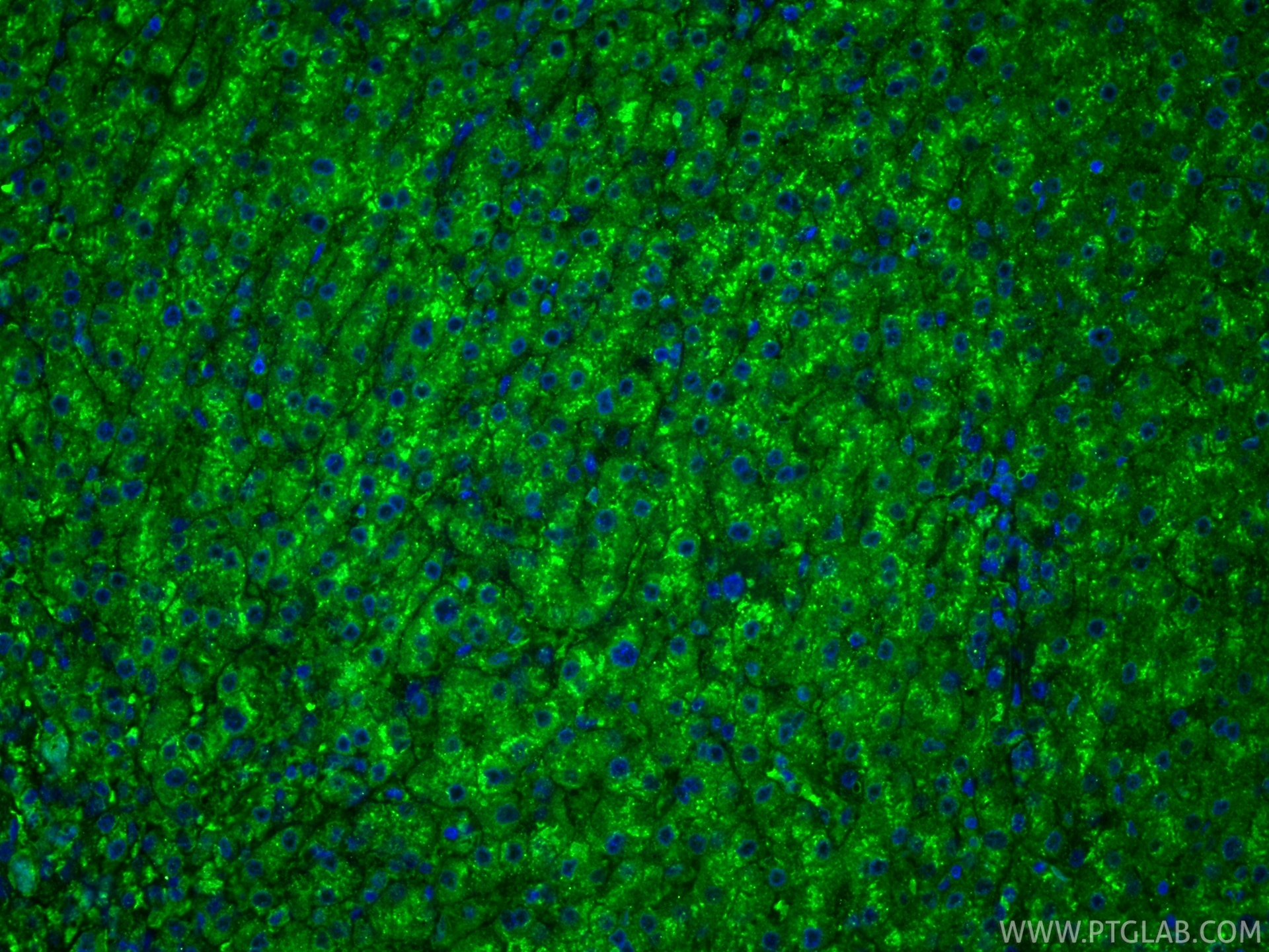 IF Staining of human liver using 67300-1-Ig Immunofluorescence (IF) / fluorescent staining of human liver tissue using CD107a / LAMP1 Monoclonal antibody (67300-1-Ig)