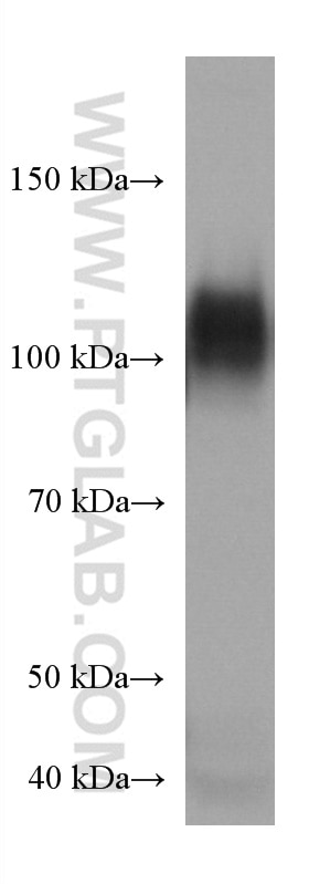 Western Blot (WB) analysis of HepG2 cells using CD107a / LAMP1 Monoclonal antibody (67300-1-Ig)