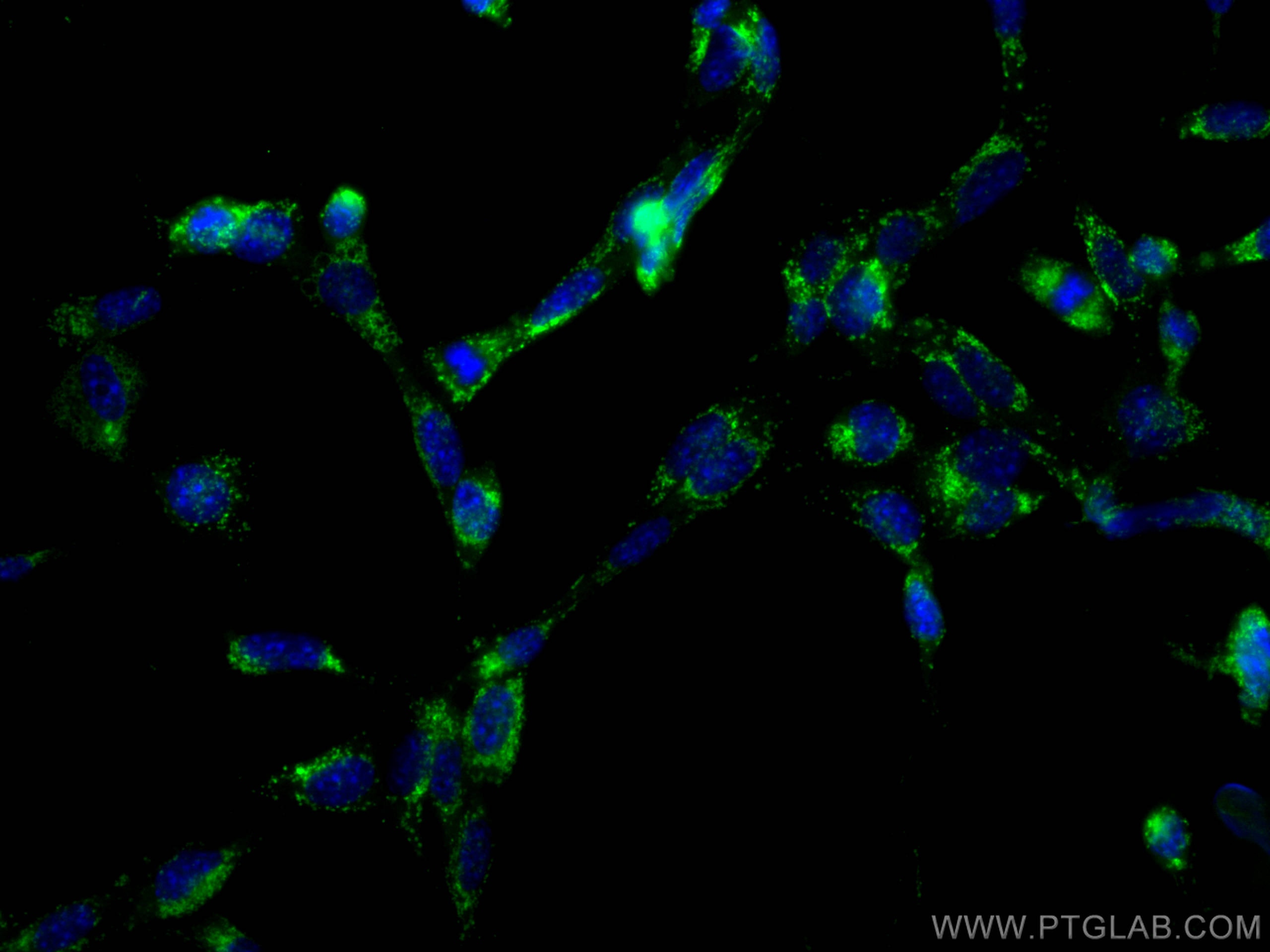 Immunofluorescence (IF) / fluorescent staining of NIH/3T3 cells using CoraLite® Plus 488 Anti-Mouse CD107a / LAMP1 (1D4B (CL488-65050)