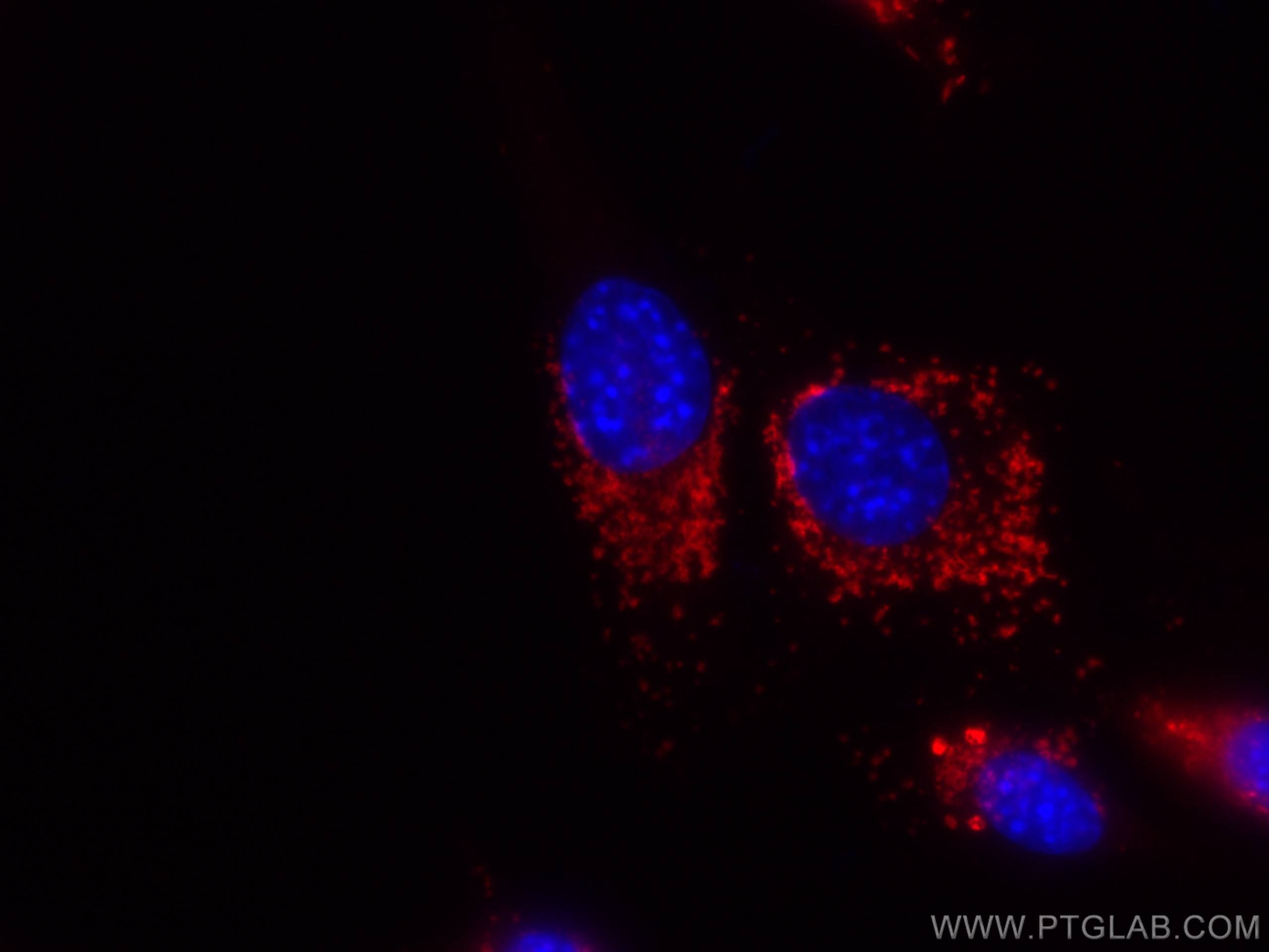 Immunofluorescence (IF) / fluorescent staining of NIH/3T3 cells using CoraLite®555 Anti-Mouse CD107a / LAMP1 (1D4B) (CL555-65050)