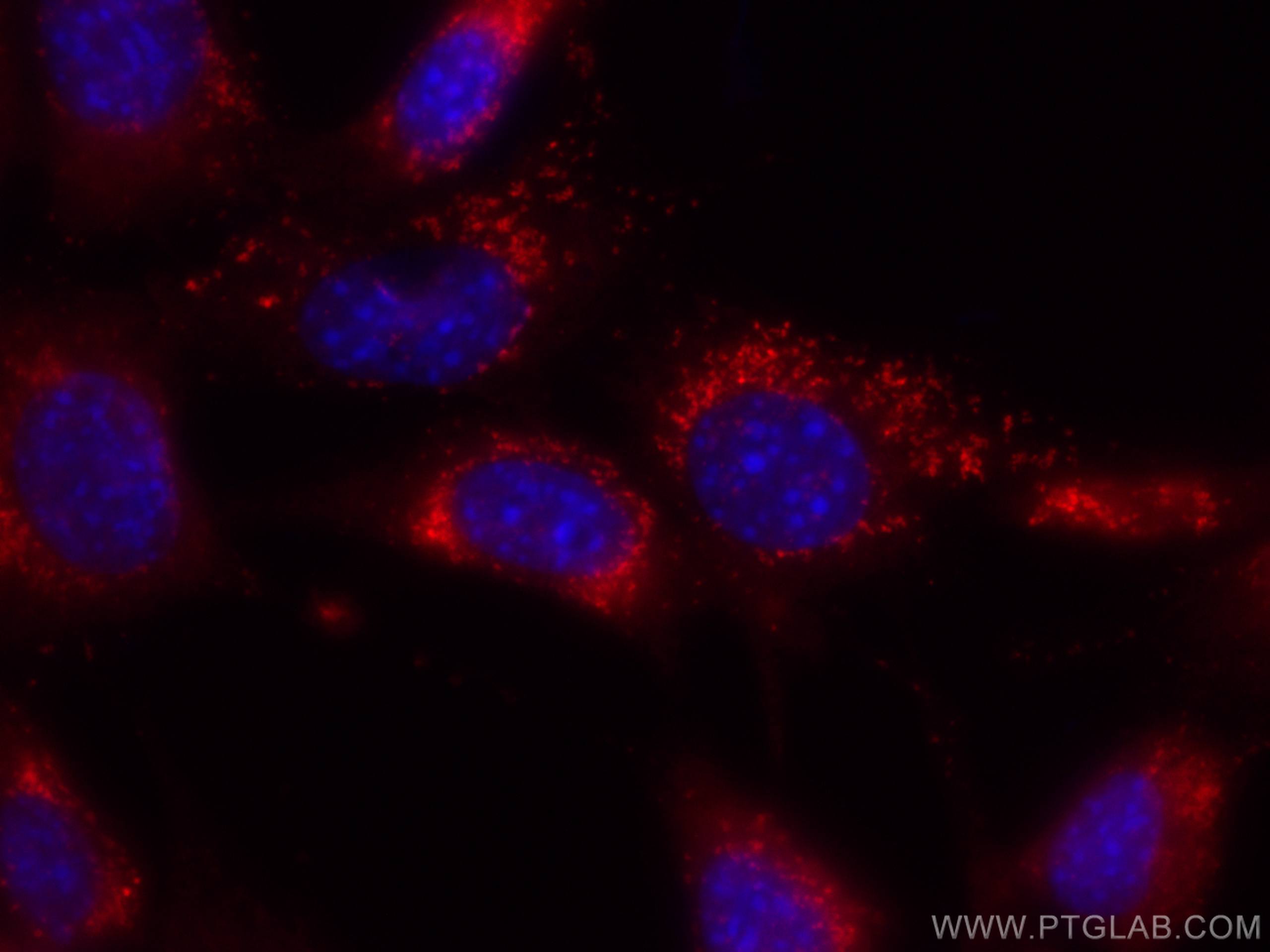 Immunofluorescence (IF) / fluorescent staining of NIH/3T3 cells using CoraLite®568 Anti-Mouse CD107a / LAMP1 (1D4B) (CL568-65050)