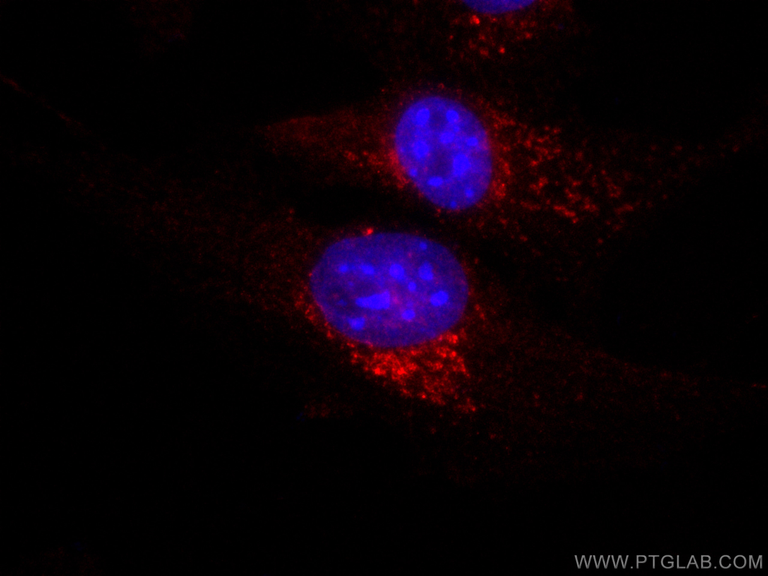 Immunofluorescence (IF) / fluorescent staining of NIH/3T3 cells using CoraLite®594 Anti-Mouse CD107a / LAMP1 (1D4B) (CL594-65050)