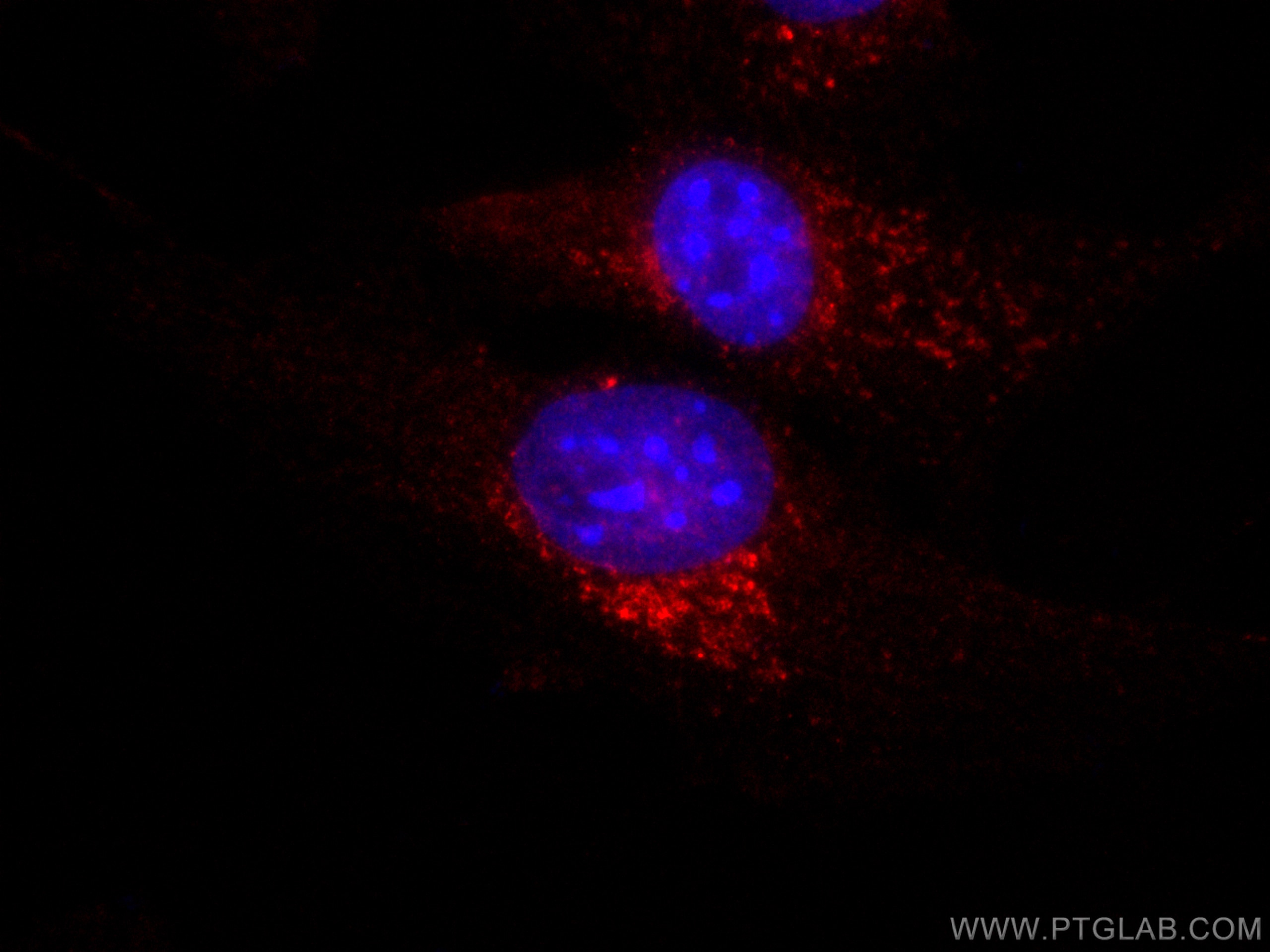 IF Staining of NIH/3T3 using CL594-65050