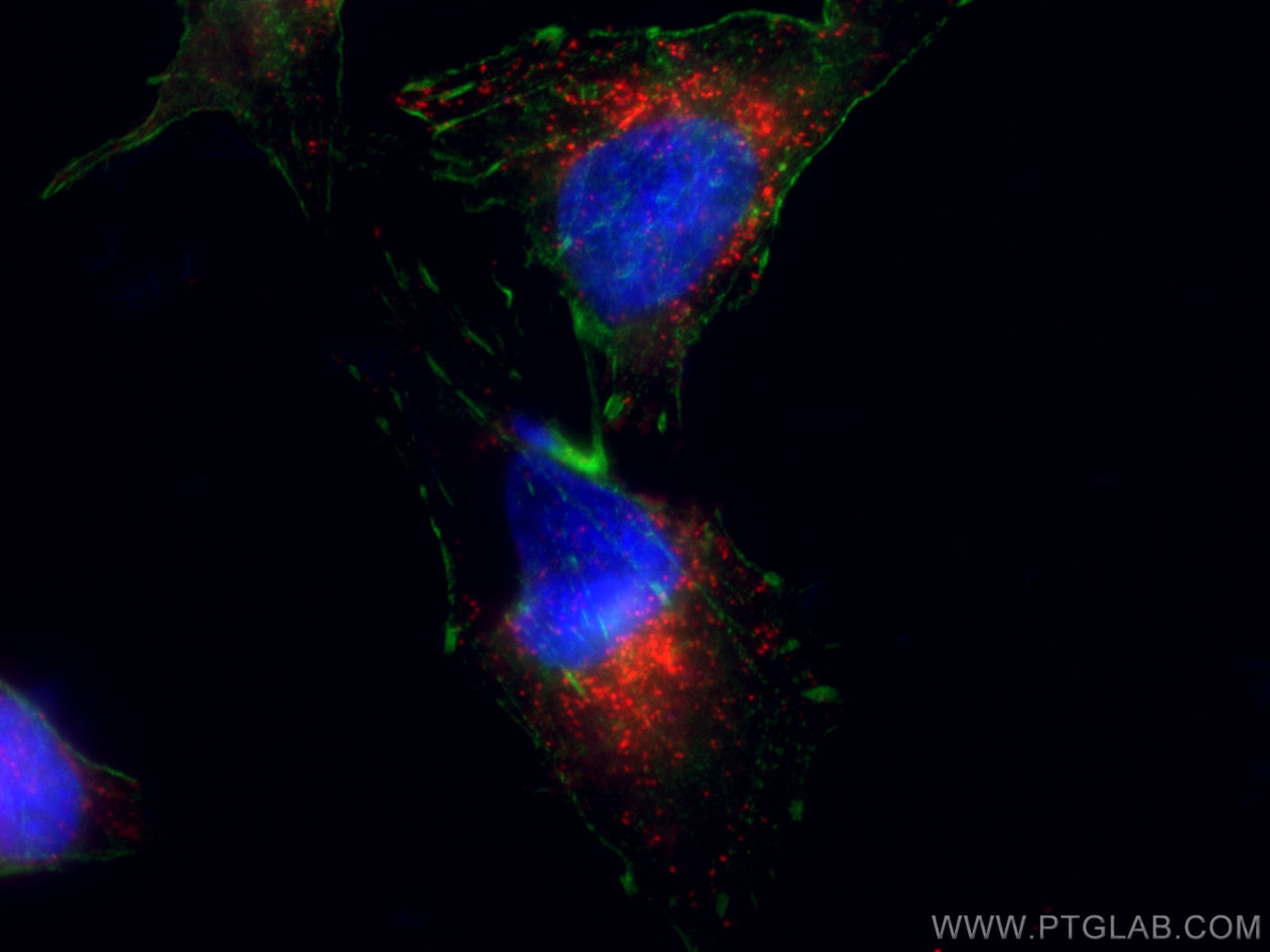 Immunofluorescence (IF) / fluorescent staining of HeLa cells using CoraLite®594 Anti-Human CD107a / LAMP1 (H4A3) (CL594-65051)