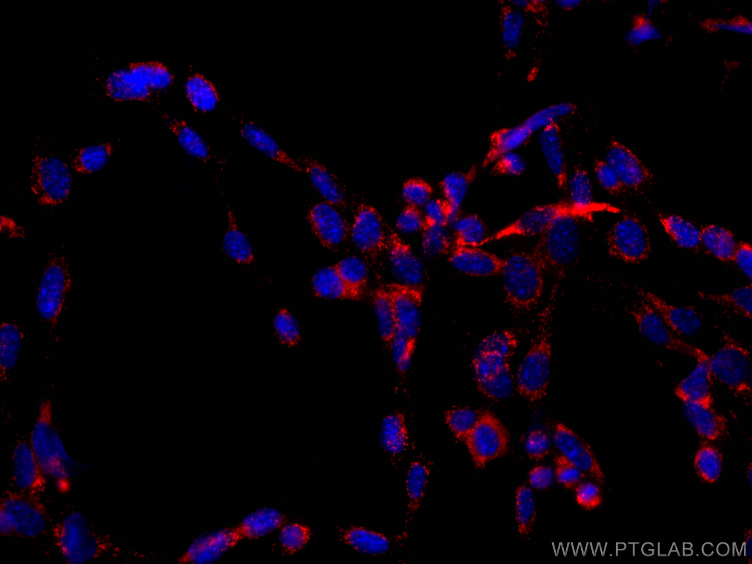 Immunofluorescence (IF) / fluorescent staining of NIH/3T3 cells using CoraLite® Plus 647 Anti-Mouse CD107a / LAMP1 (1D4B (CL647-65050)