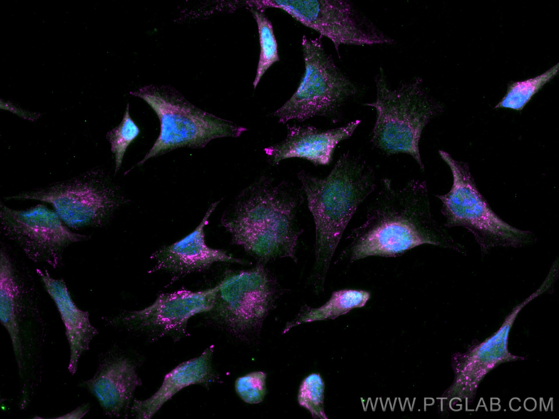 Immunofluorescence (IF) / fluorescent staining of HeLa cells using CoraLite® Plus 647 Anti-Human CD107a / LAMP1 (H4A3 (CL647-65051)