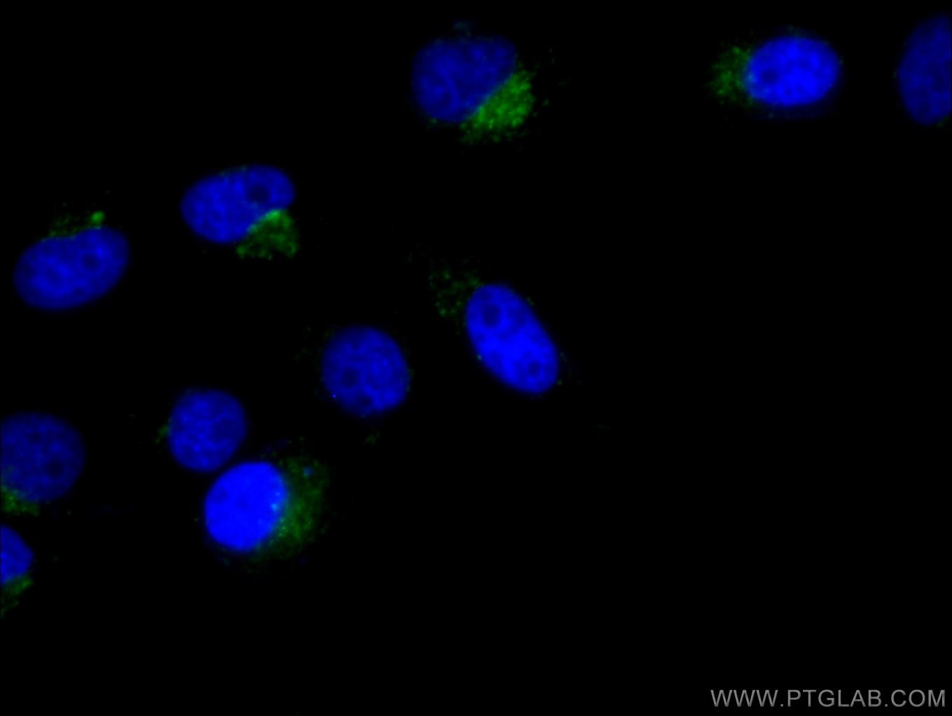 Immunofluorescence (IF) / fluorescent staining of HeLa cells using FITC Plus Anti-Human CD107a / LAMP1 (H4A3) (FITC-65051)