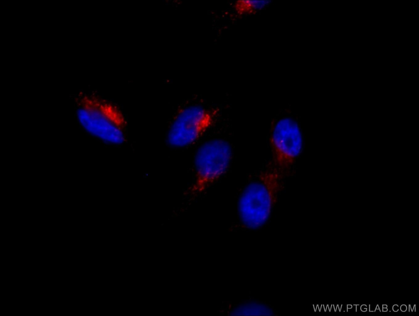 Immunofluorescence (IF) / fluorescent staining of HeLa cells using PE Anti-Human CD107a / LAMP1 (H4A3) (PE-65051)