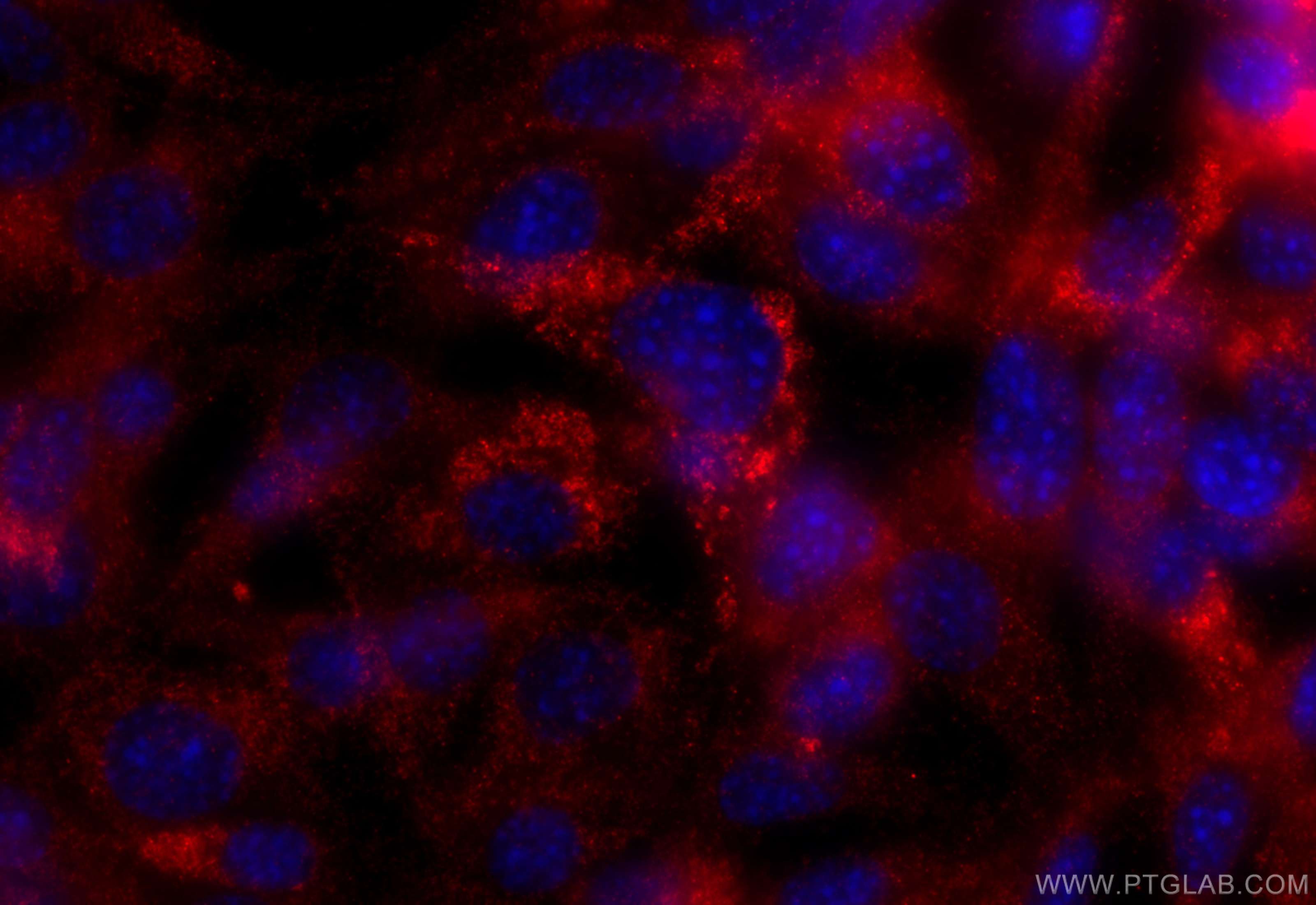 Immunofluorescence (IF) / fluorescent staining of NIH/3T3 cells using CD107a / LAMP1 Polyclonal antibody (32435-1-AP)