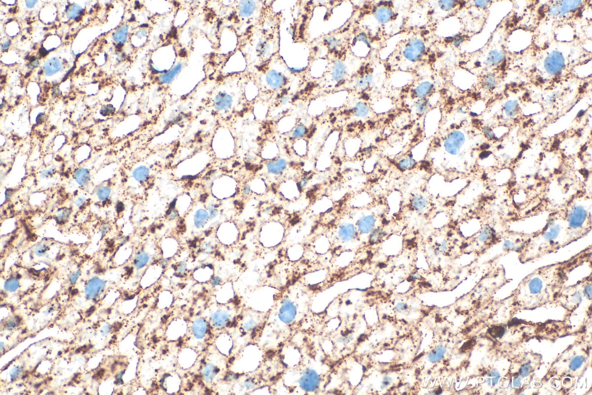 Immunohistochemical analysis of paraffin-embedded mouse liver tissue slide using 33243-1-AP (CD107a / LAMP1 antibody) at dilution of 1:1000 (under 40x lens). Heat mediated antigen retrieval with Tris-EDTA buffer (pH 9.0). Immunohistochemistry (IHC) staining of mouse liver tissue using CD107a / LAMP1 Polyclonal antibody (33243-1-AP)