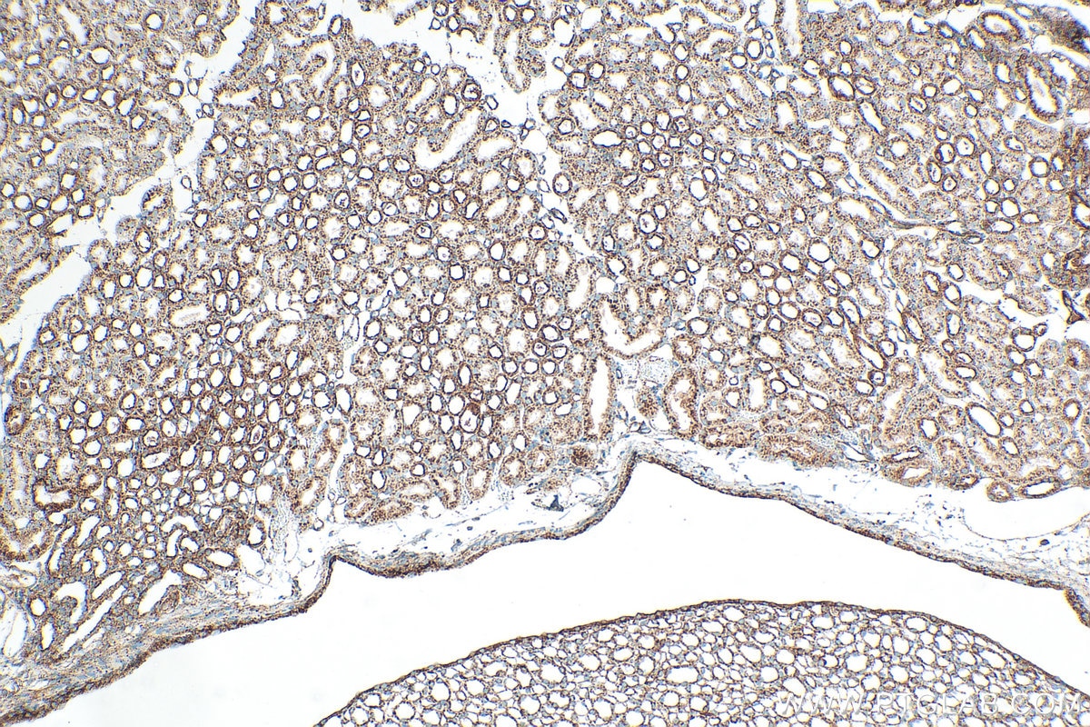 Immunohistochemical analysis of paraffin-embedded mouse kidney tissue slide using 33243-1-AP (CD107a / LAMP1 antibody) at dilution of 1:1000 (under 10x lens). Heat mediated antigen retrieval with Tris-EDTA buffer (pH 9.0). Immunohistochemistry (IHC) staining of mouse kidney tissue using CD107a / LAMP1 Polyclonal antibody (33243-1-AP)