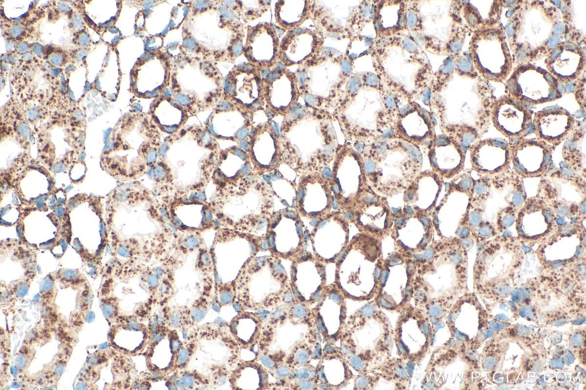 Immunohistochemical analysis of paraffin-embedded mouse kidney tissue slide using 33243-1-AP (CD107a / LAMP1 antibody) at dilution of 1:1000 (under 40x lens). Heat mediated antigen retrieval with Tris-EDTA buffer (pH 9.0). Immunohistochemistry (IHC) staining of mouse kidney tissue using CD107a / LAMP1 Polyclonal antibody (33243-1-AP)