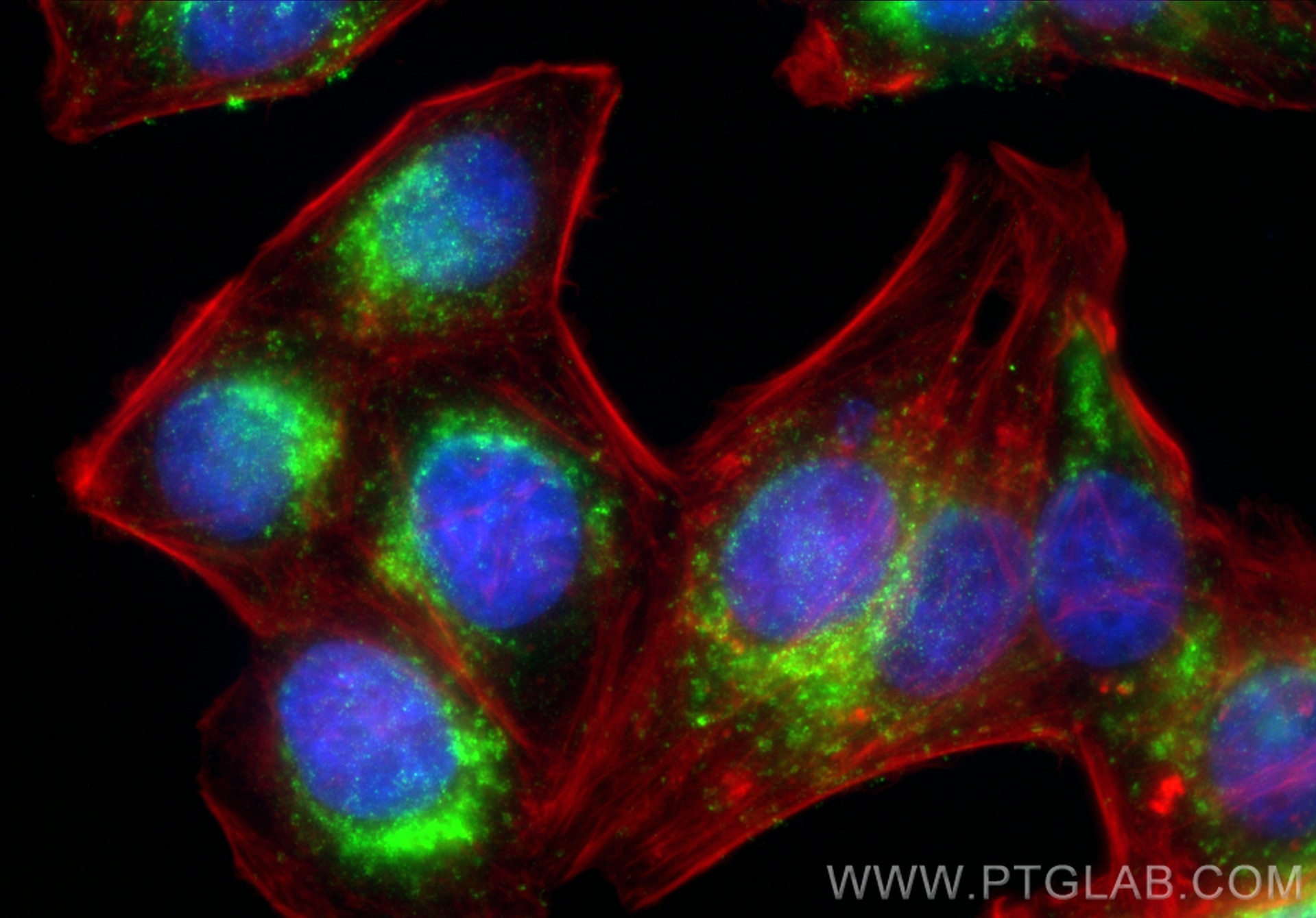 Immunofluorescence (IF) / fluorescent staining of HepG2 cells using Anti-Human CD107a / LAMP1 (H4A3) Mouse IgG2a Recom (65596-1-MR)