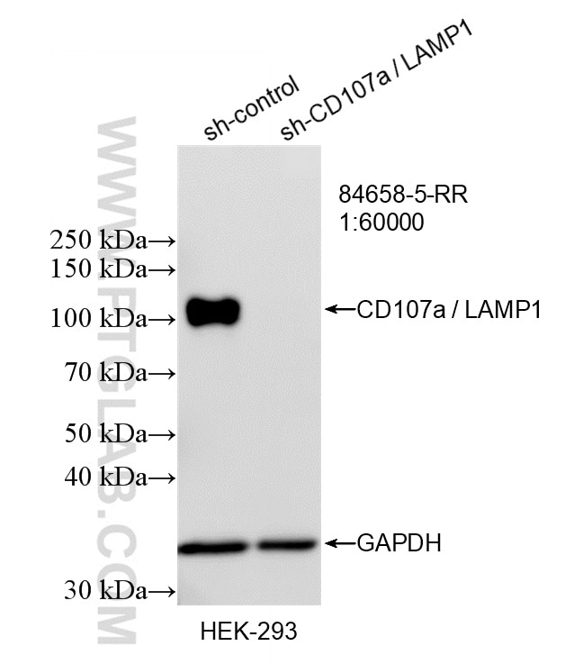 WB result of CD107a / LAMP1 antibody (84658-5-RR; 1:60000; incubated at room temperature for 1.5 hours) with sh-Control and sh-CD107a / LAMP1 transfected HEK-293 cells. Western Blot (WB) analysis of HEK-293 cells using CD107a / LAMP1 Recombinant monoclonal antibody (84658-5-RR)