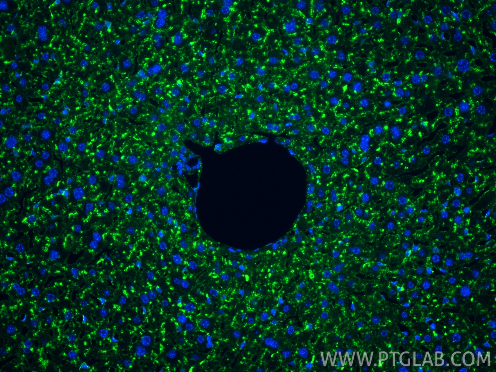 Immunofluorescence (IF) / fluorescent staining of mouse liver tissue using CD107a / LAMP1 Recombinant monoclonal antibody (86337-2-RR)
