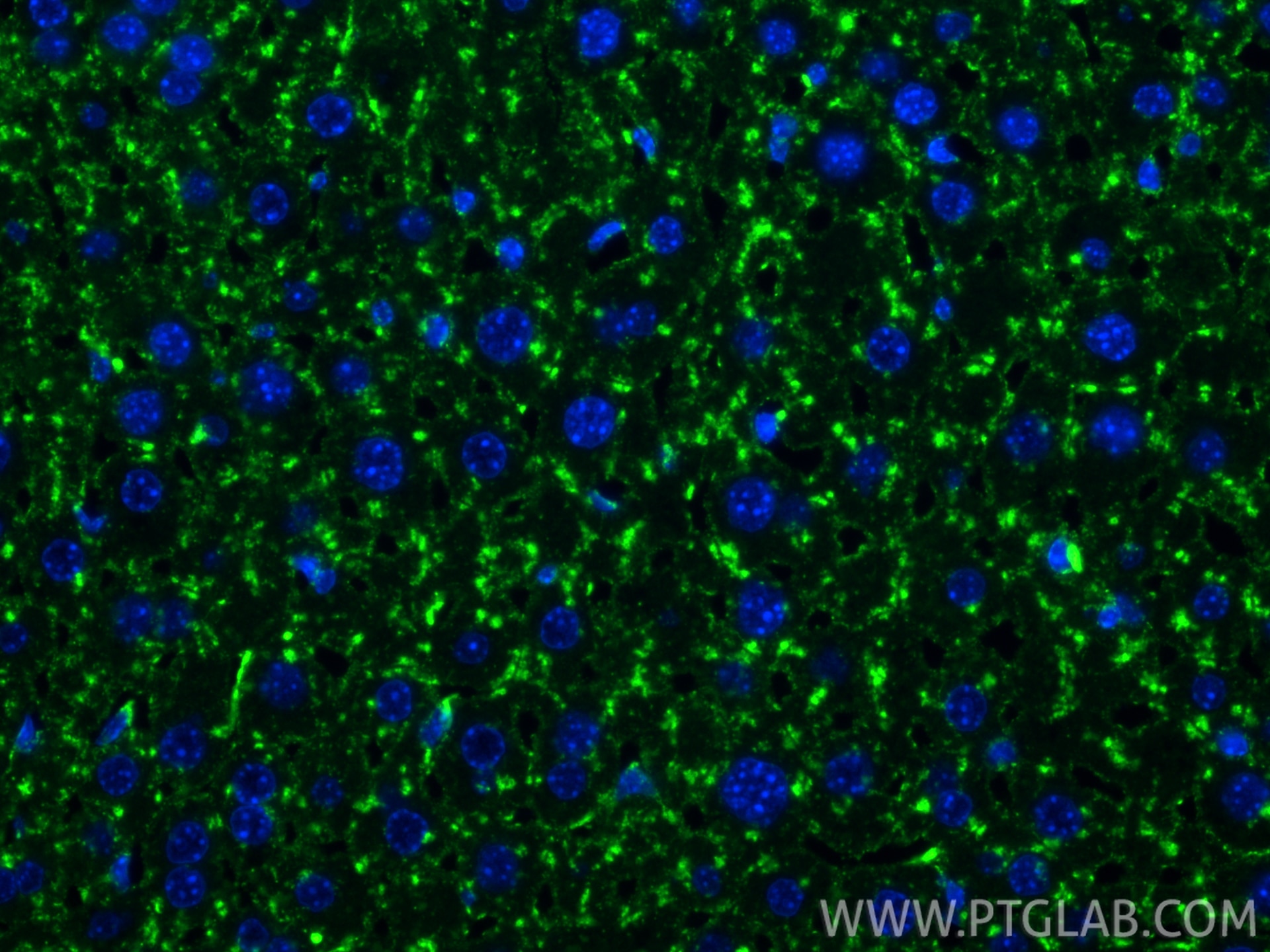 Immunofluorescence (IF) / fluorescent staining of mouse liver tissue using CD107a / LAMP1 Recombinant monoclonal antibody (86337-2-RR)