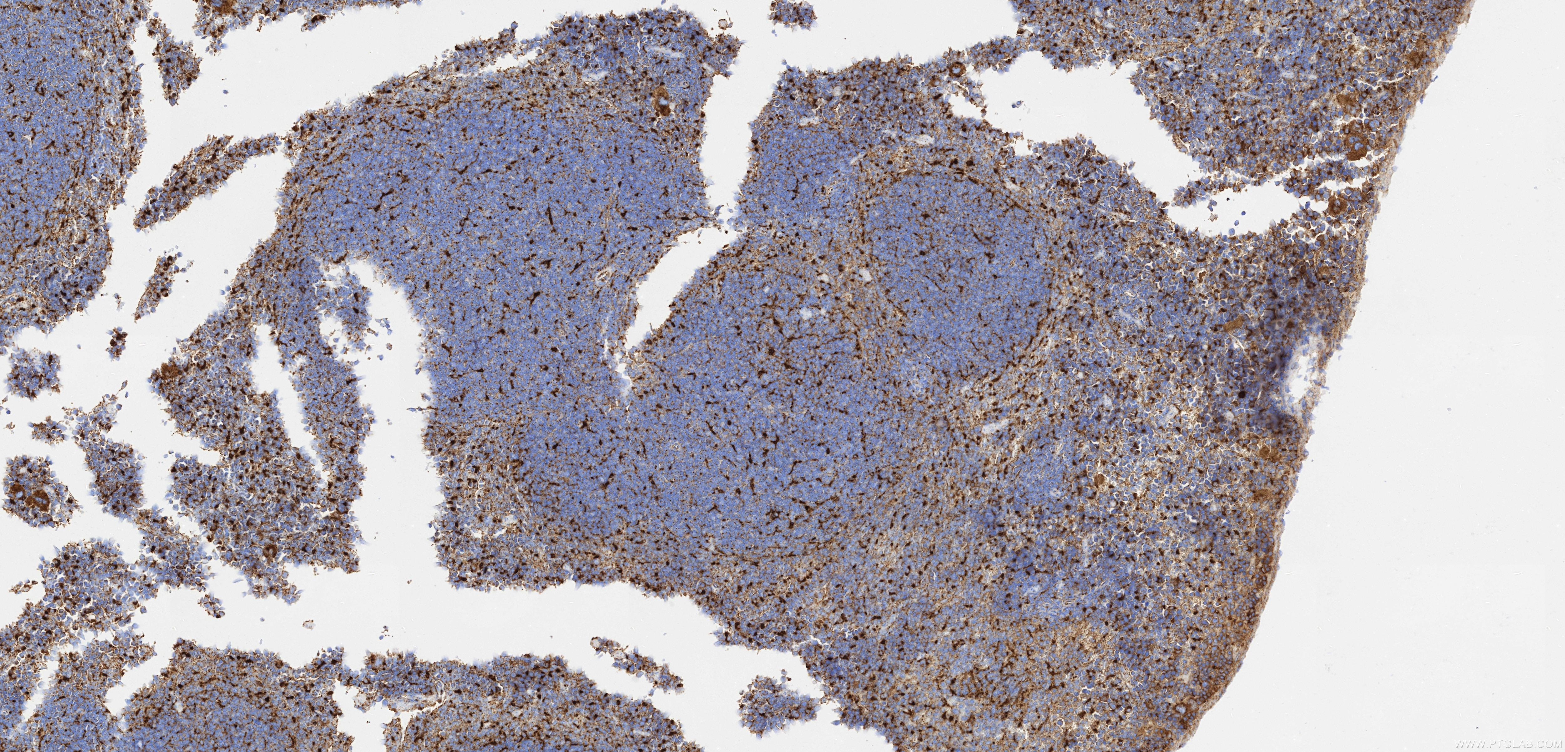 IHC staining of mouse spleen using 86337-2-RR (same clone as 86337-2-PBS) Immunohistochemistry (IHC) staining of mouse spleen tissue using CD107a / LAMP1 Recombinant monoclonal antibody (86337-2-RR)