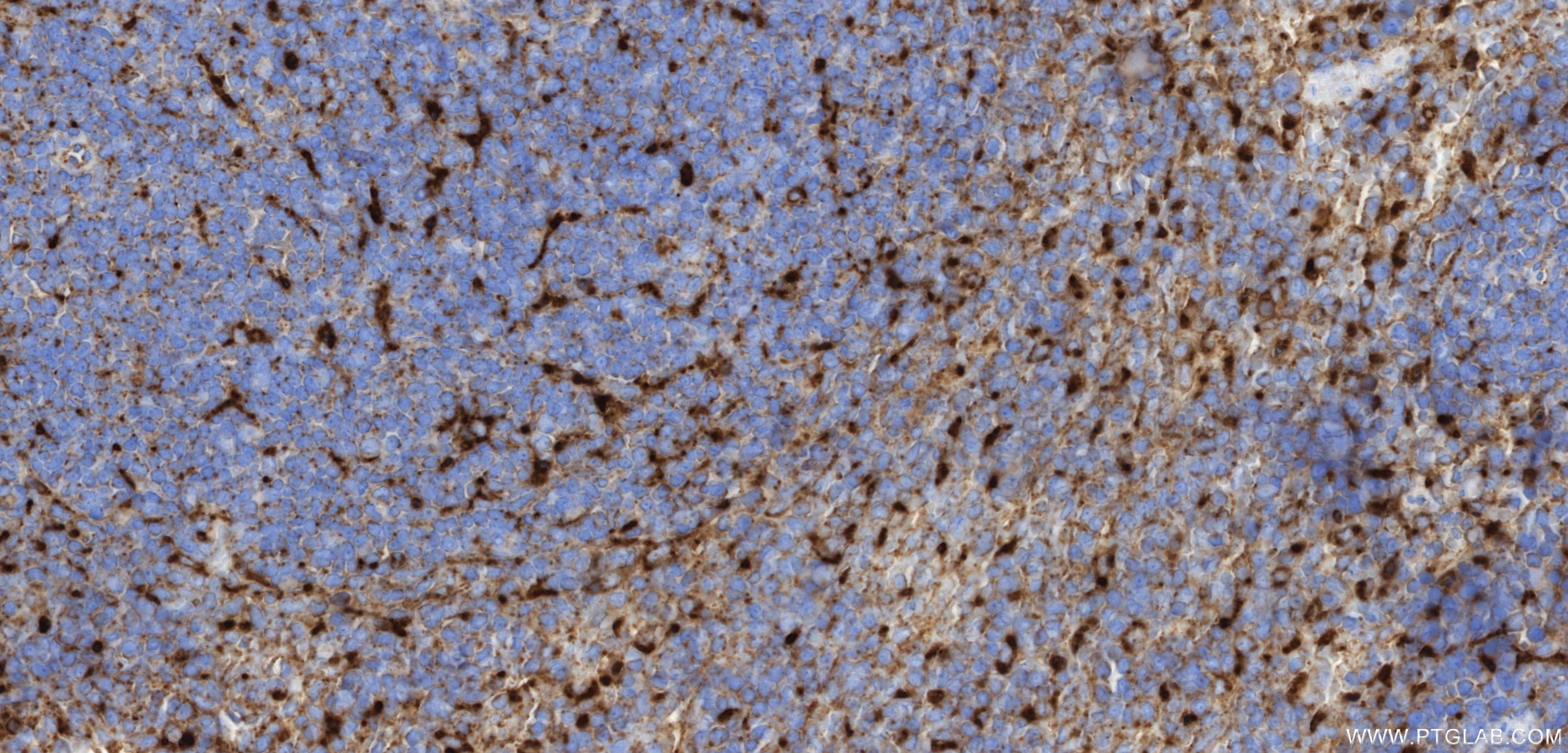 IHC staining of mouse spleen using 86337-2-RR (same clone as 86337-2-PBS) Immunohistochemistry (IHC) staining of mouse spleen tissue using CD107a / LAMP1 Recombinant monoclonal antibody (86337-2-RR)