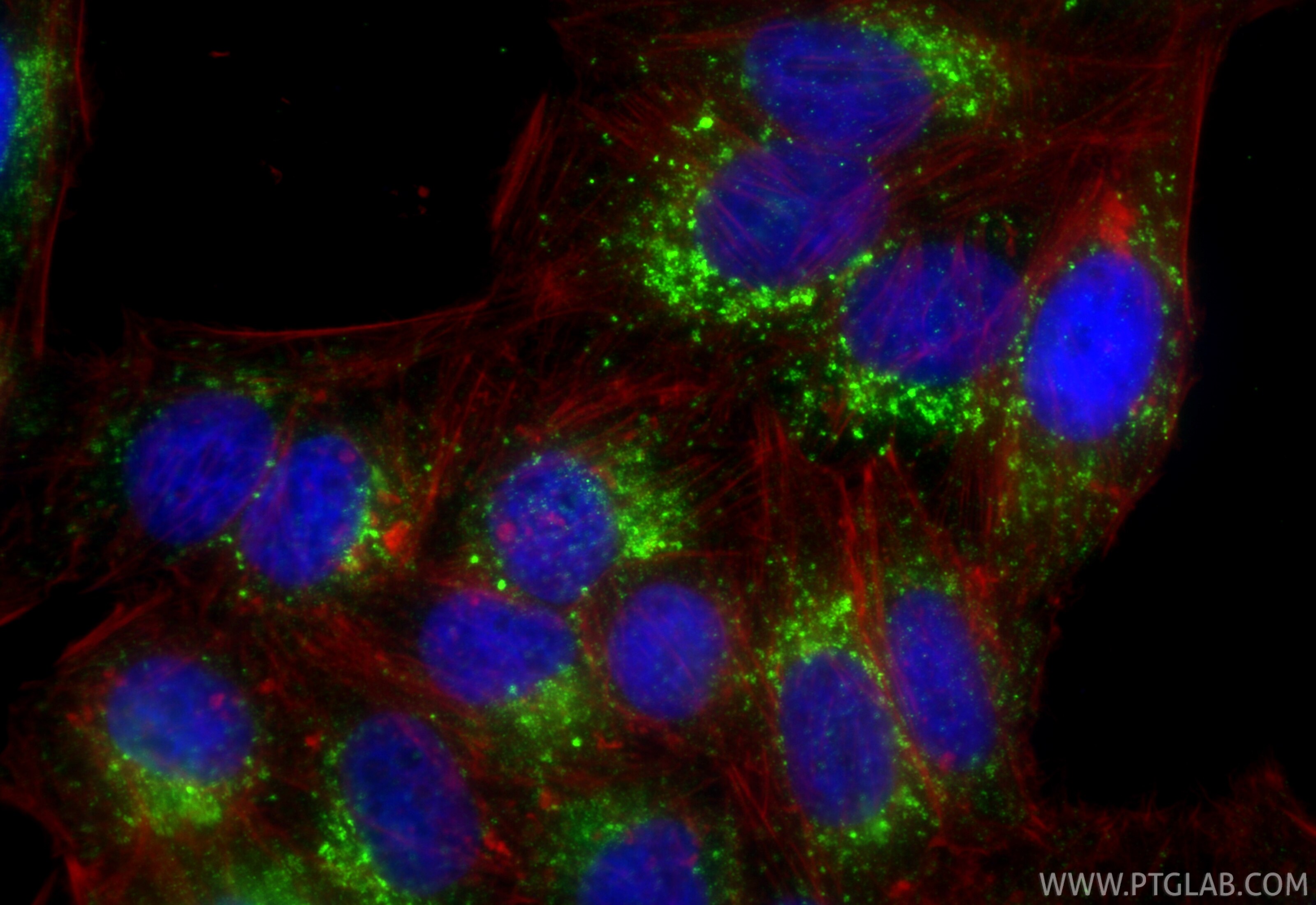 Immunofluorescence (IF) / fluorescent staining of HepG2 cells using Anti-Human CD107a / LAMP1 Rabbit Recombinant Antib (98266-2-RR)