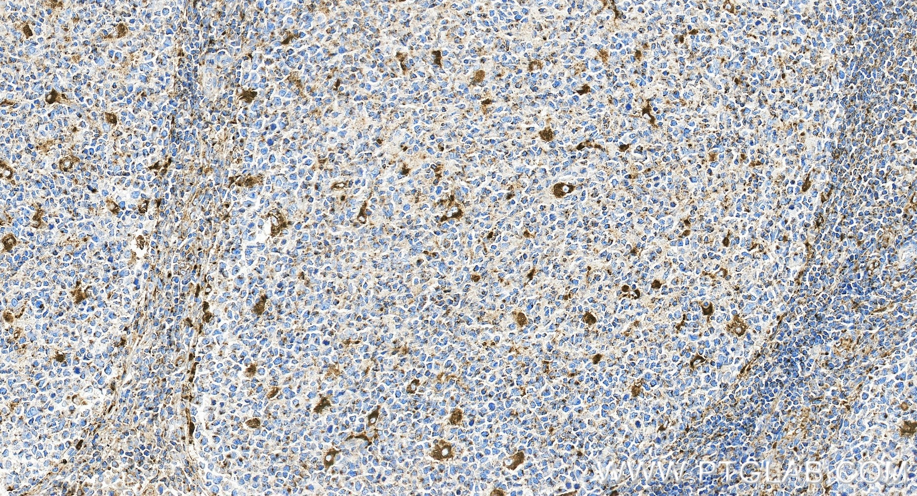Immunohistochemistry (IHC) staining of human tonsillitis tissue using Anti-Human CD107a / LAMP1 Rabbit Recombinant Antib (98266-2-RR)