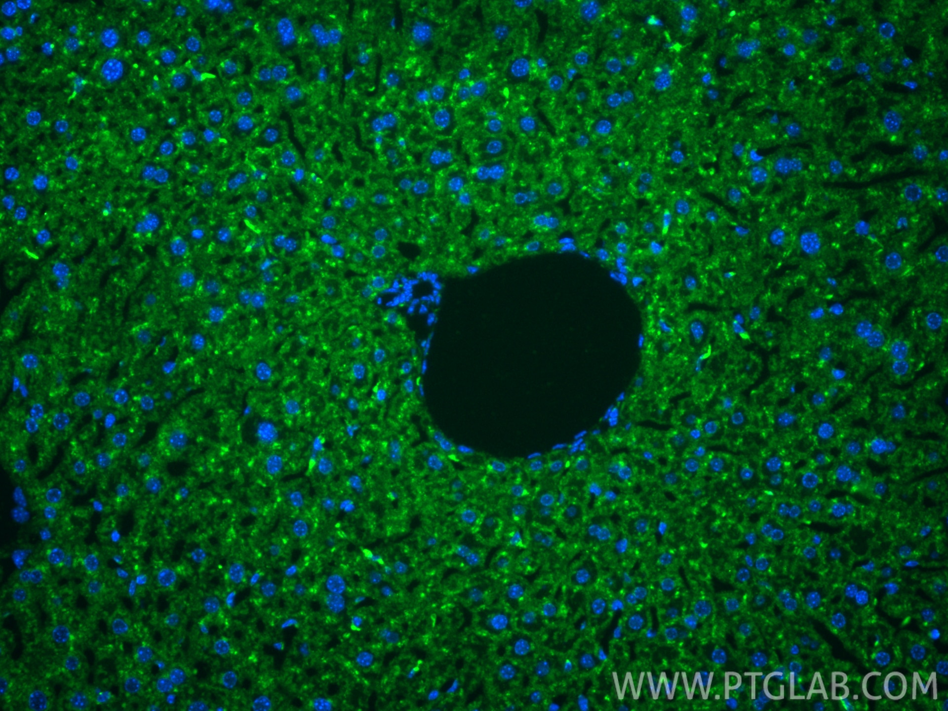 Immunofluorescence (IF) / fluorescent staining of mouse liver tissue using Anti-Mouse CD107a / LAMP1 Rabbit Recombinant Antib (98537-2-RR)