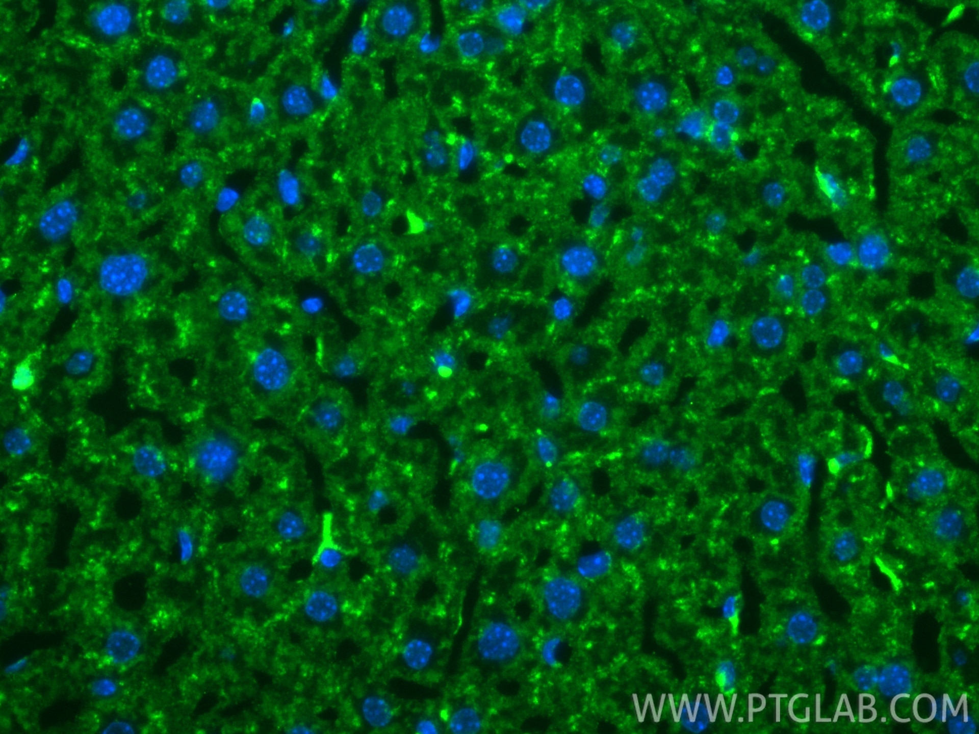 Immunofluorescence (IF) / fluorescent staining of mouse liver tissue using Anti-Mouse CD107a / LAMP1 Rabbit Recombinant Antib (98537-2-RR)