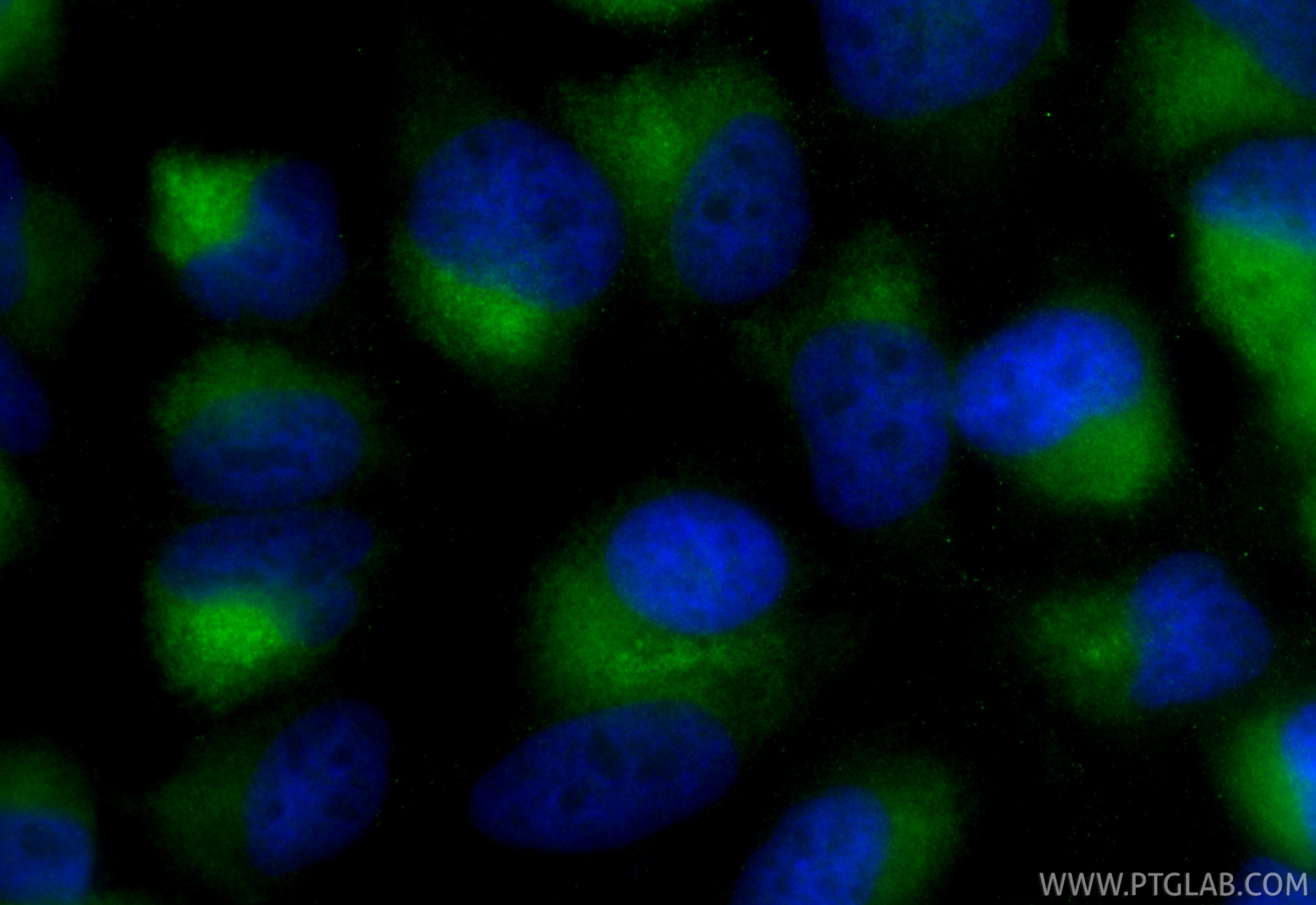 Immunofluorescence (IF) / fluorescent staining of HeLa cells using CoraLite® Plus 488 Anti-Human CD107a / LAMP1 Rabbi (CL488-SF98266-2)