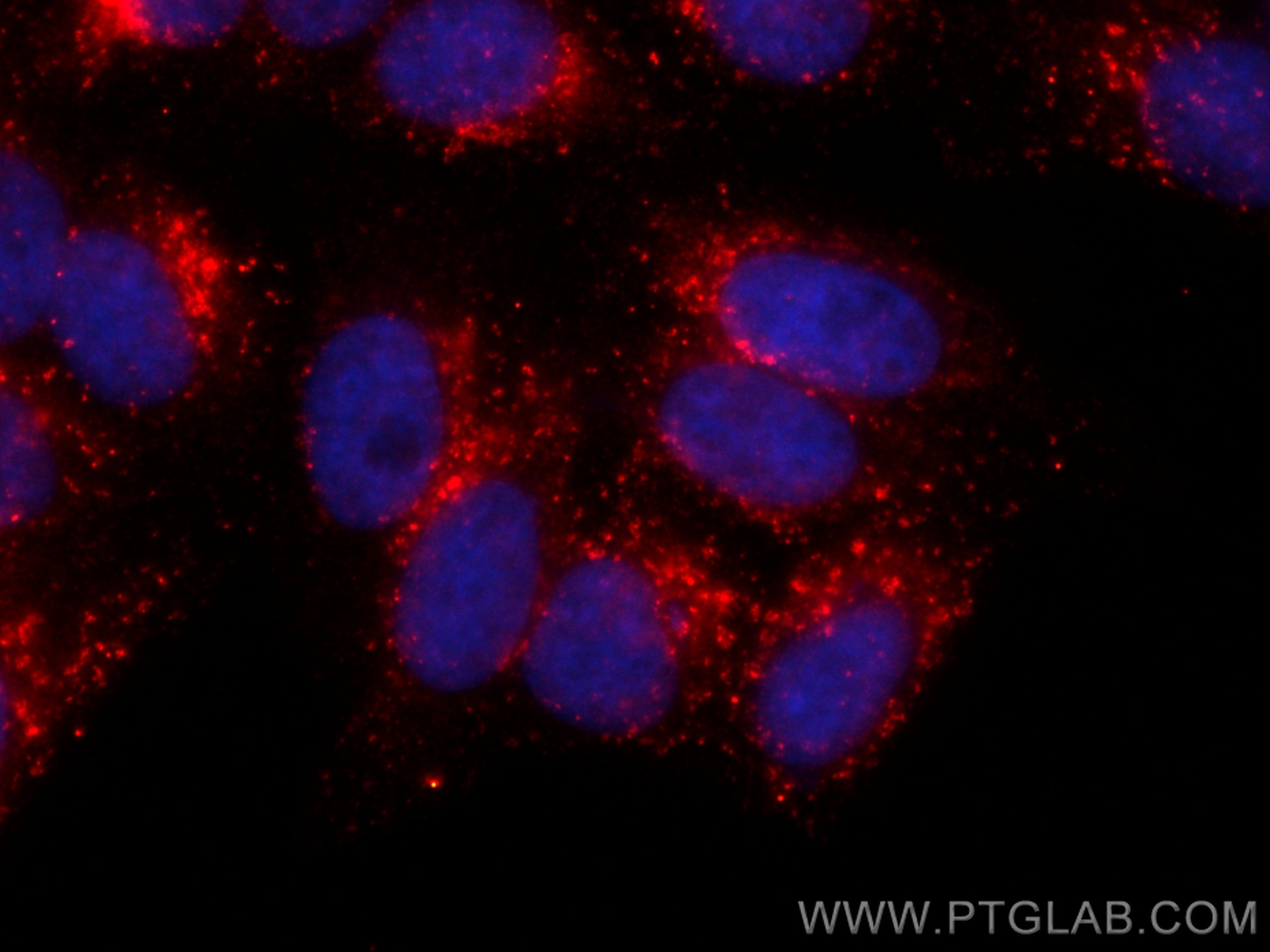 Immunofluorescence (IF) / fluorescent staining of HepG2 cells using CoraLite®594-conjugated CD107a / LAMP1 Recombinant (CL594-84658-5)