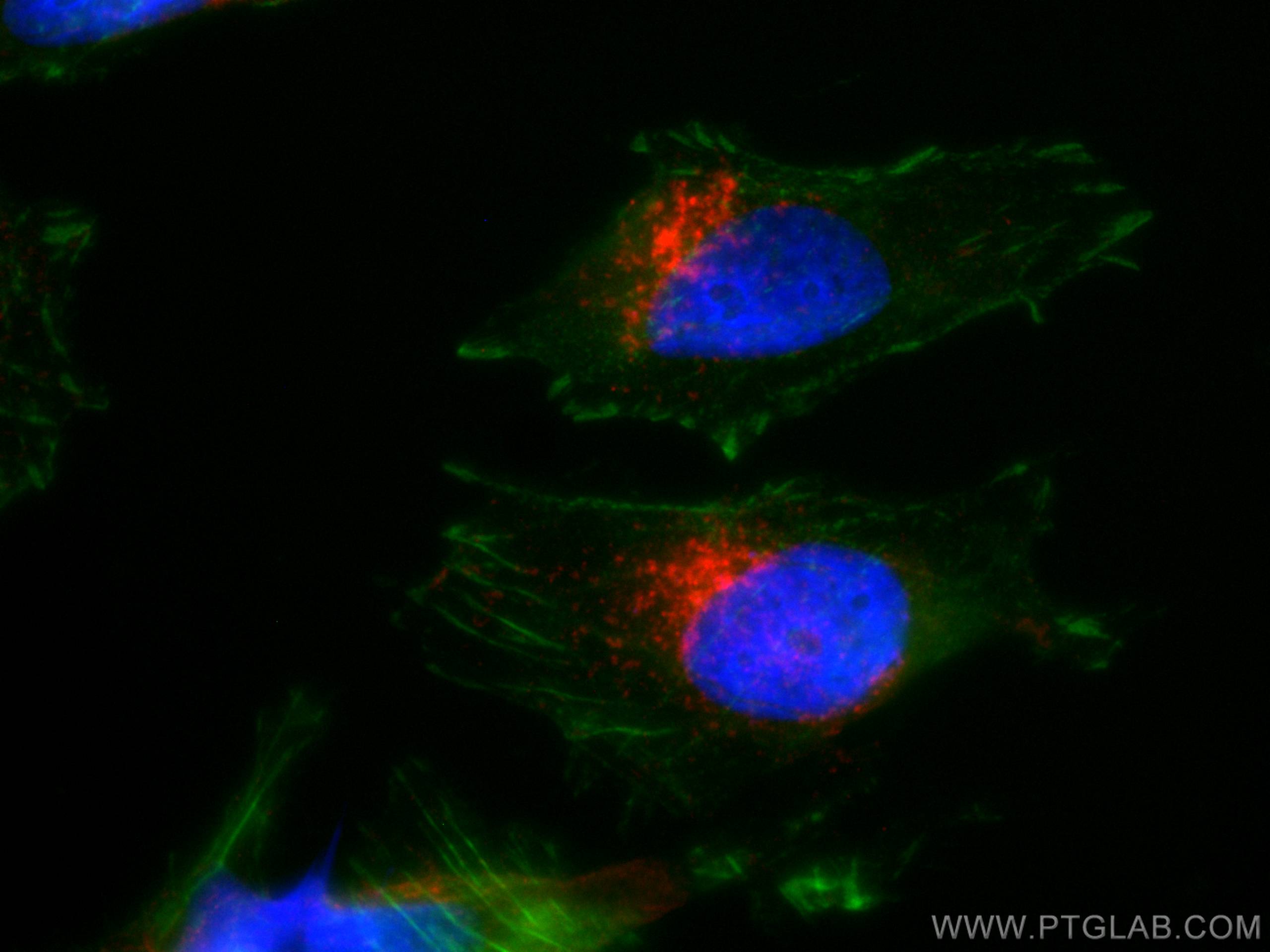 Immunofluorescence (IF) / fluorescent staining of HeLa cells using CoraLite® Plus 647 Anti-Human CD107a / LAMP1 (H4A3 (CL647-65051)