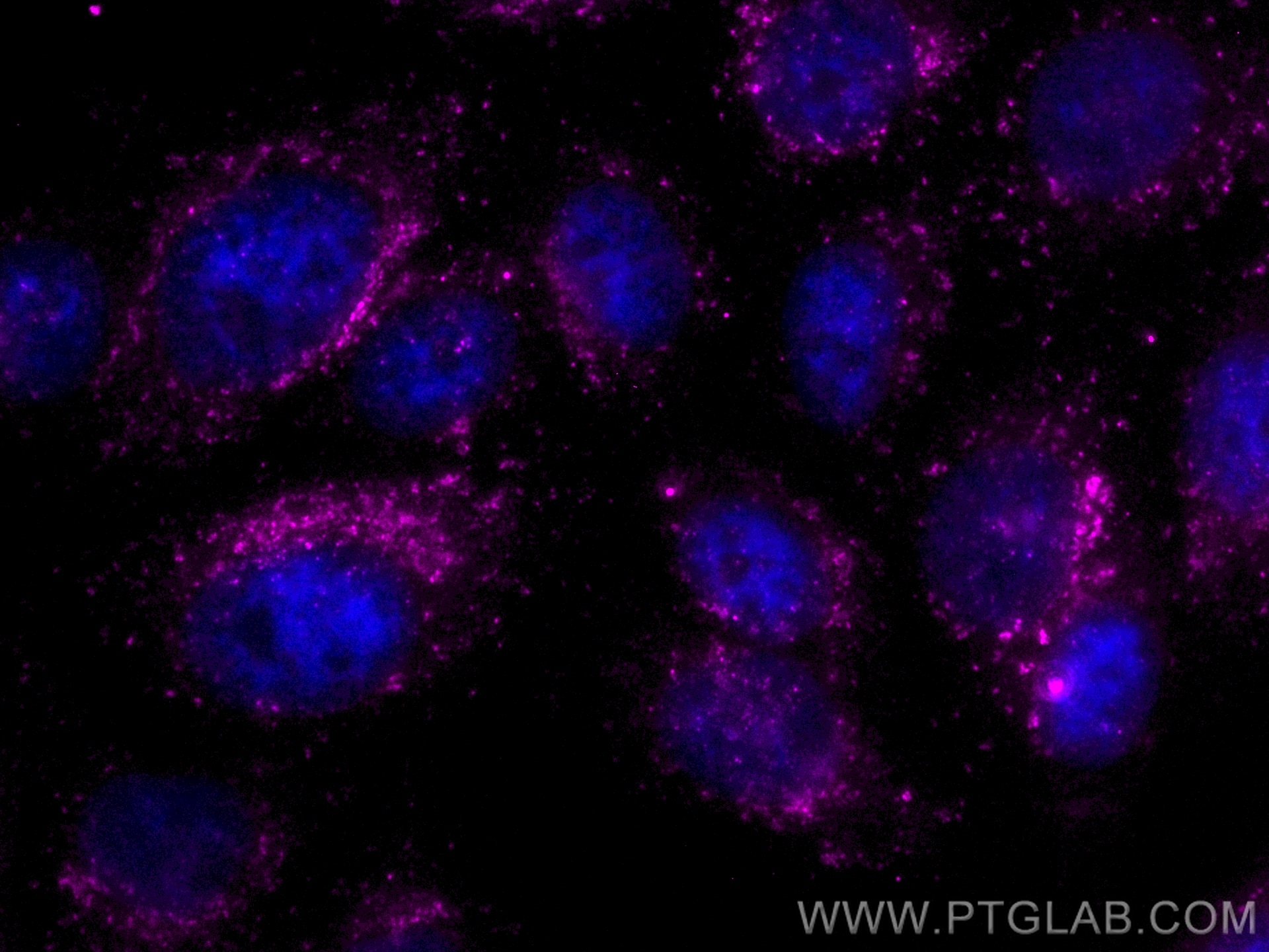 Immunofluorescence (IF) / fluorescent staining of HepG2 cells using CoraLite® Plus 647-conjugated CD107a / LAMP1 Recom (CL647-84658-5)