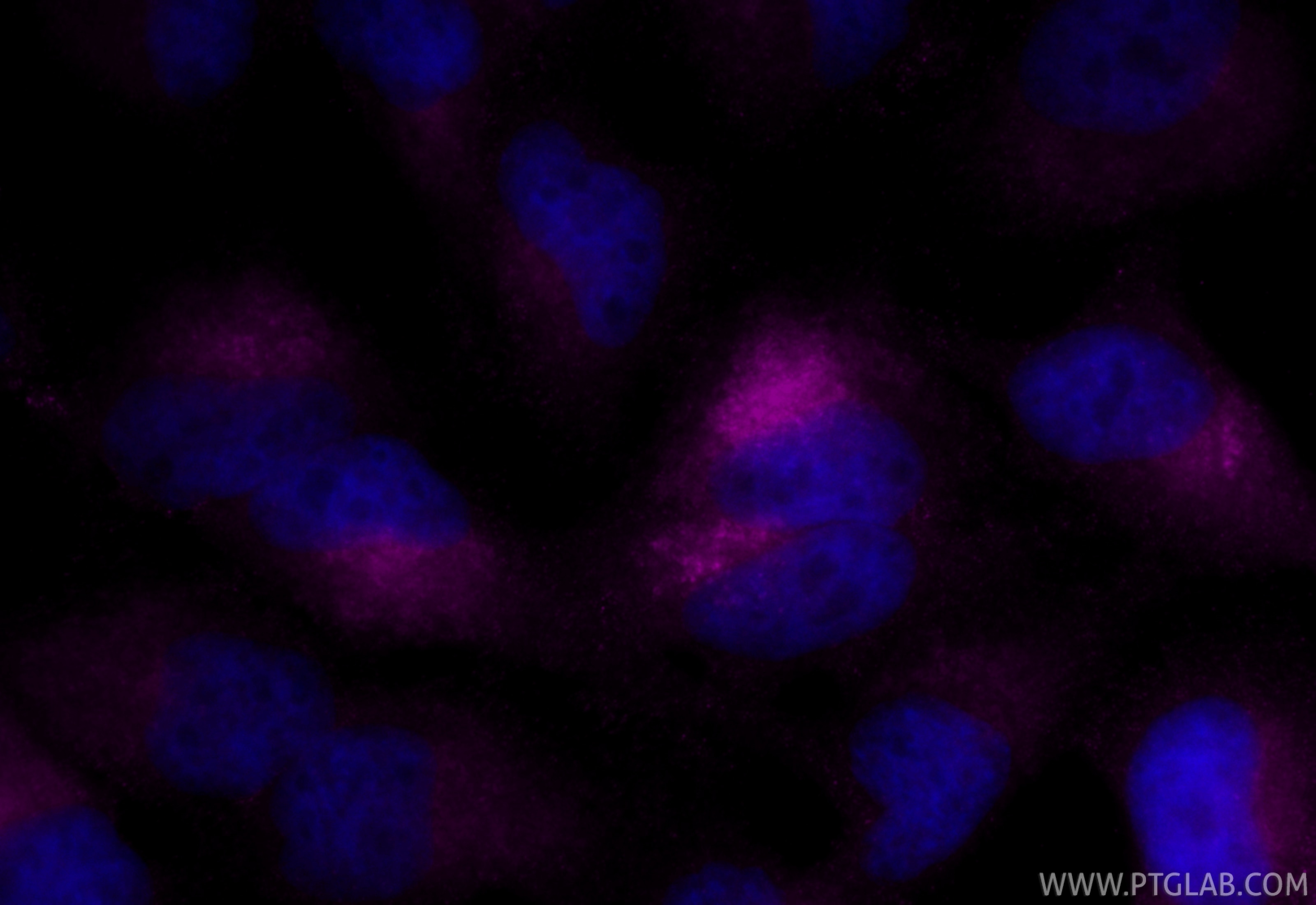 Immunofluorescence (IF) / fluorescent staining of HeLa cells using CoraLite® Plus 647 Anti-Human CD107a / LAMP1 Rabbi (CL647-SF98266-2)