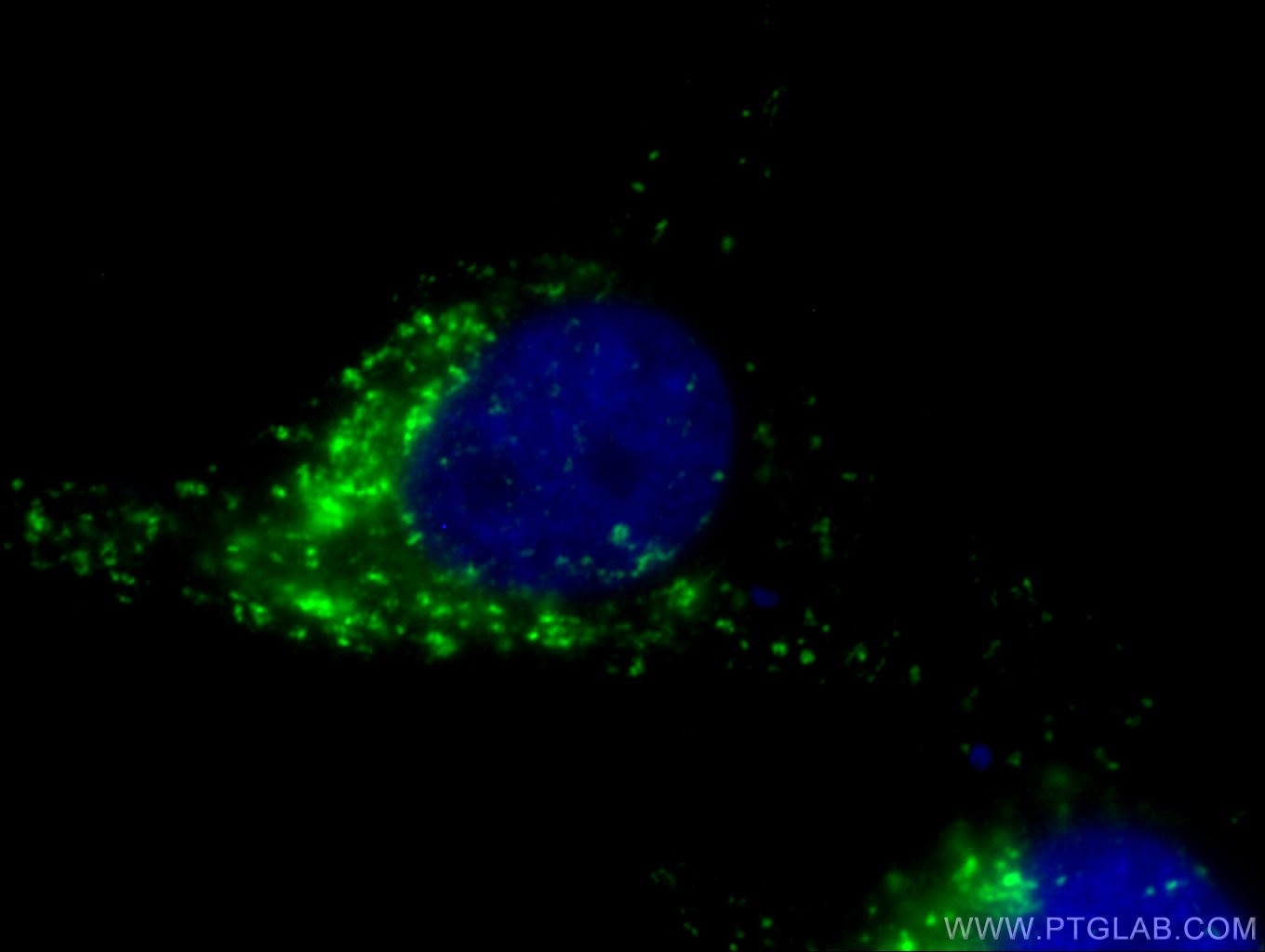 Immunofluorescence (IF) / fluorescent staining of HeLa cells using Anti-Human CD107b / LAMP2 (H4B4) (65053-1-Ig)