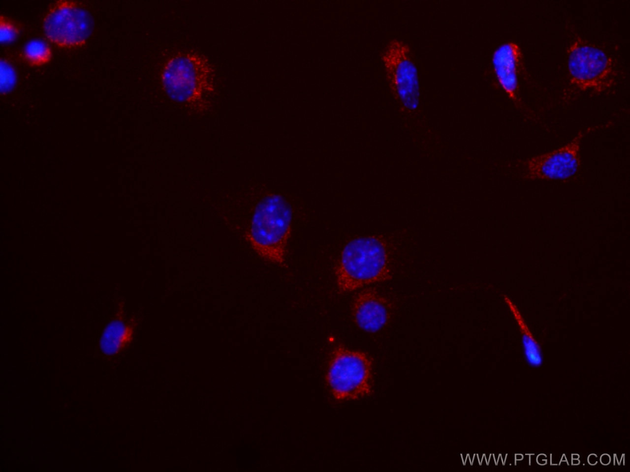 Immunofluorescence (IF) / fluorescent staining of NIH/3T3 cells using APC Anti-Mouse CD107b / LAMP2 (ABL-93) (APC-65052)