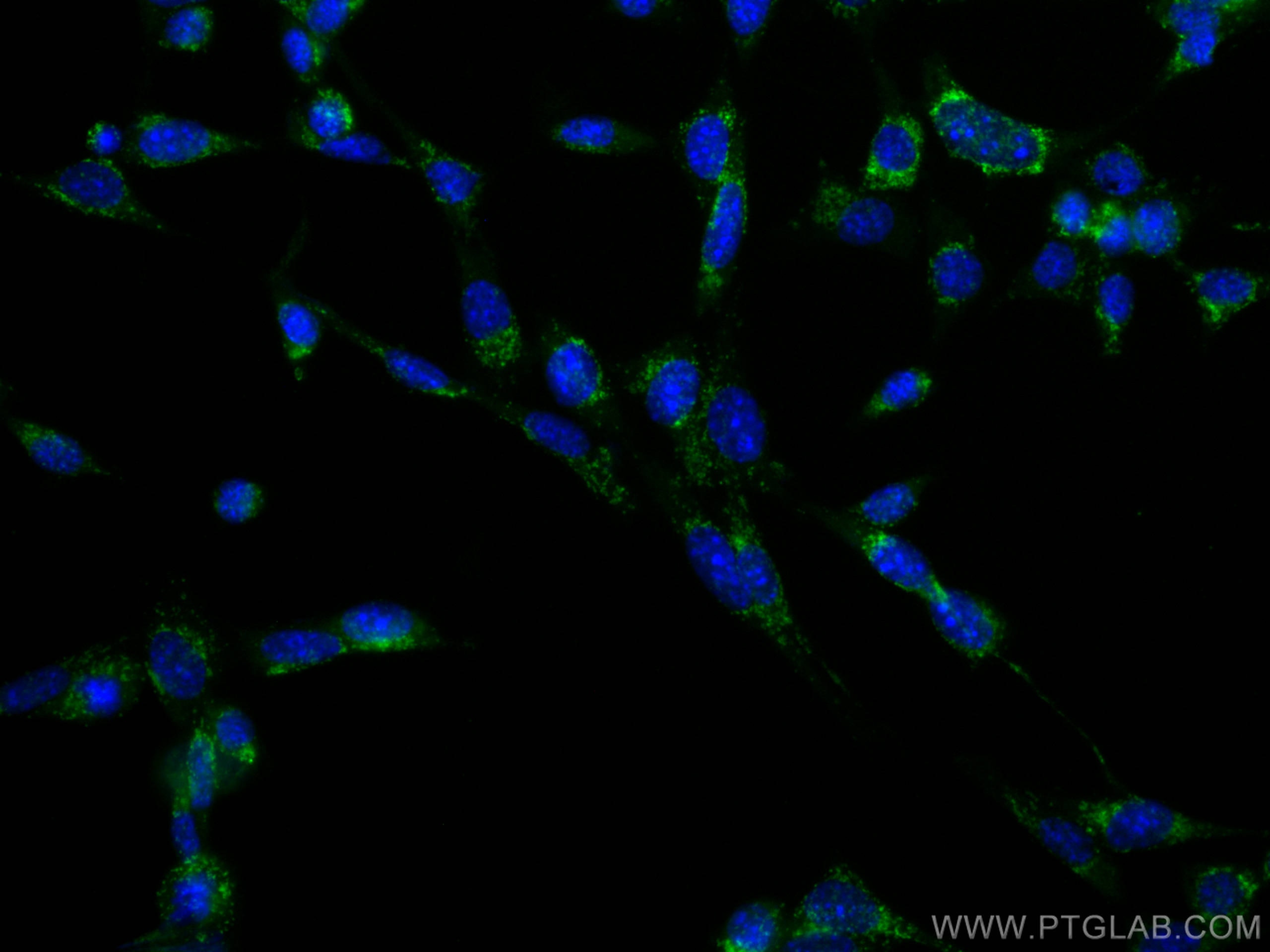 Immunofluorescence (IF) / fluorescent staining of NIH/3T3 cells using CoraLite® Plus 488 Anti-Mouse CD107b / LAMP2 (ABL- (CL488-65052)