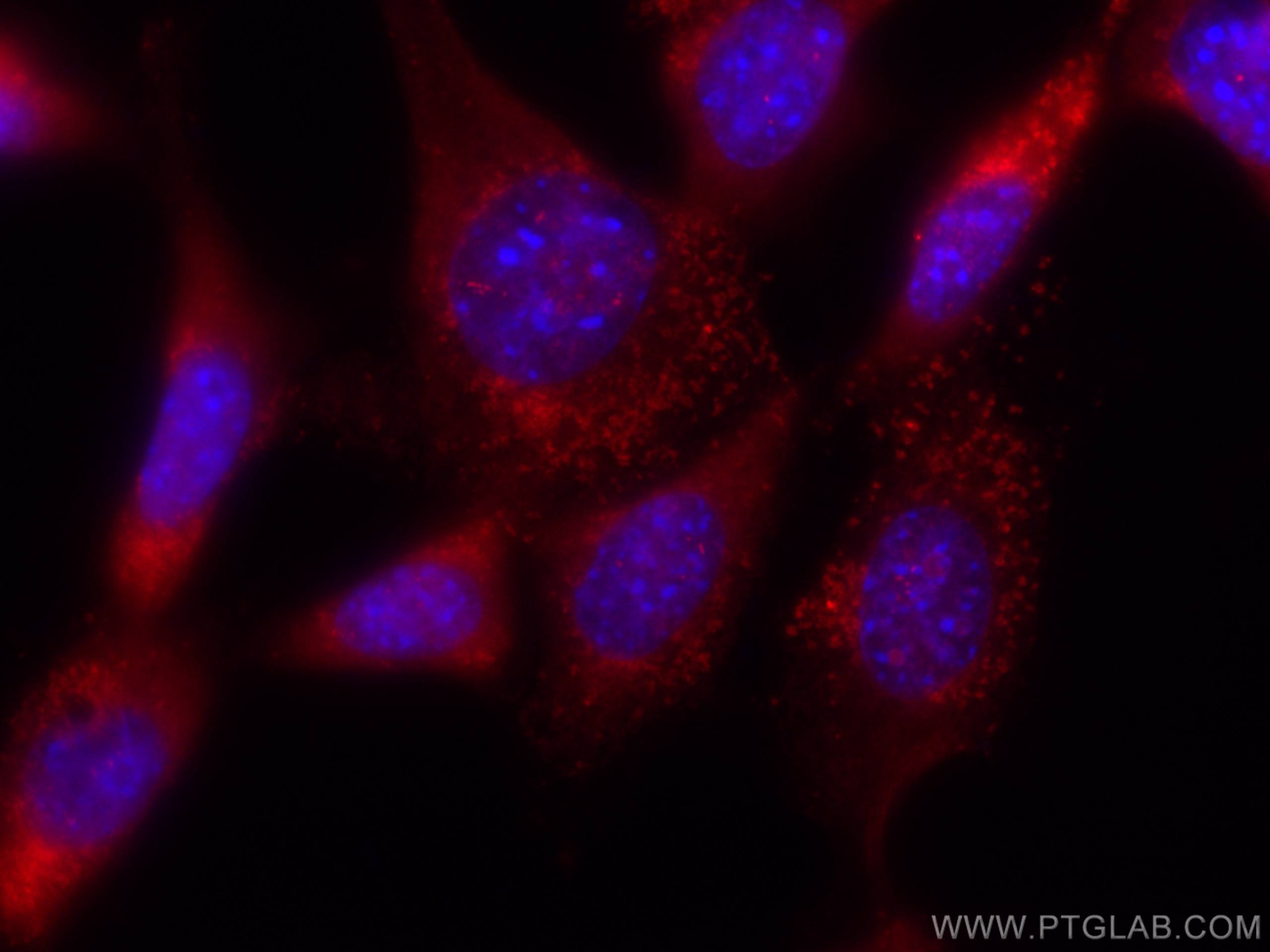 IF Staining of NIH/3T3 using CL568-65052