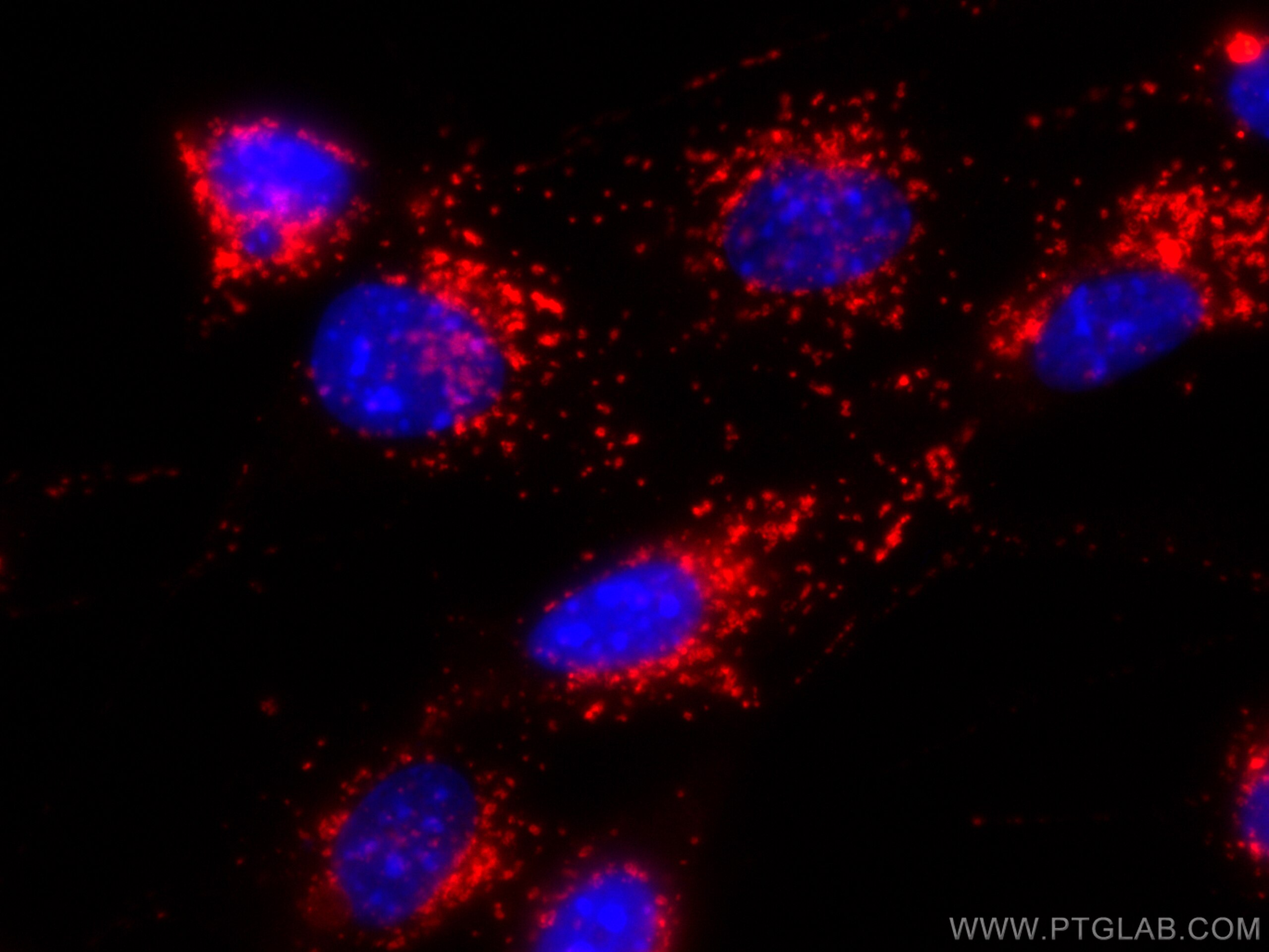 Immunofluorescence (IF) / fluorescent staining of NIH/3T3 cells using CoraLite®594 Anti-Mouse CD107b / LAMP2 (ABL-93) (CL594-65052)