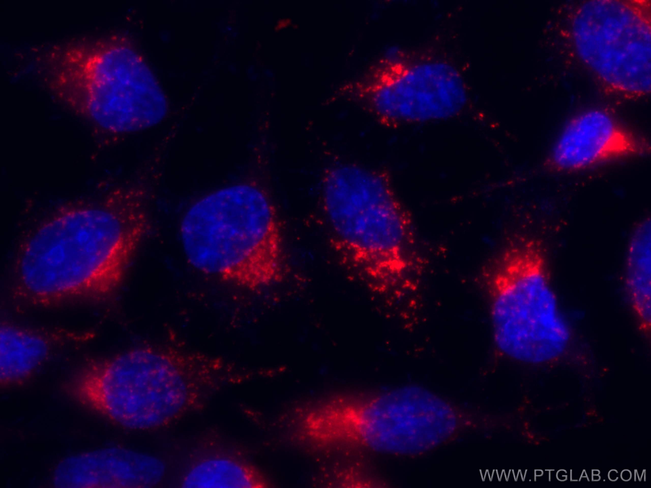 Immunofluorescence (IF) / fluorescent staining of HeLa cells using CoraLite®594 Anti-Human CD107b / LAMP2 (H4B4) (CL594-65053)