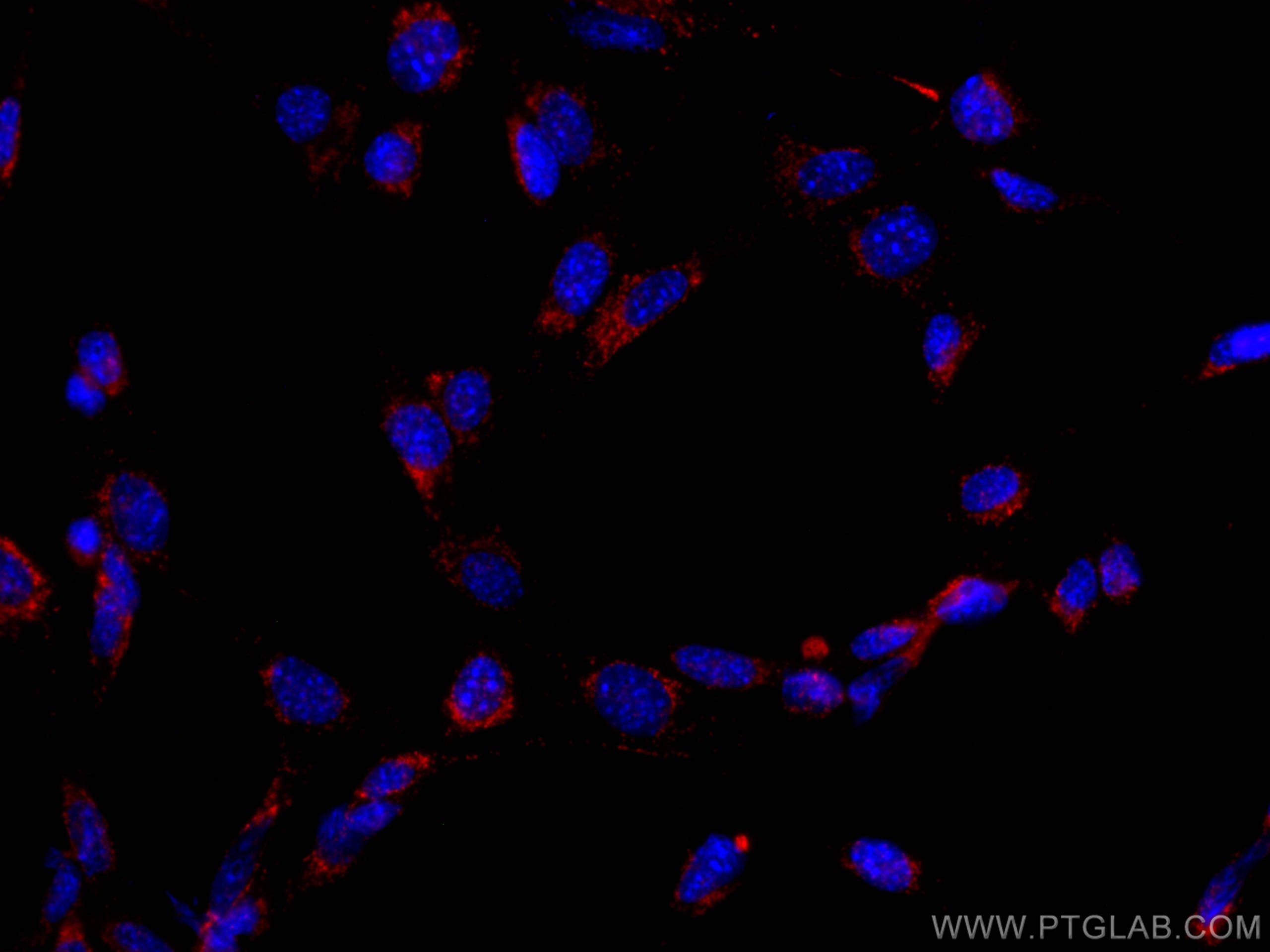 Immunofluorescence (IF) / fluorescent staining of NIH/3T3 cells using CoraLite® Plus 647 Anti-Mouse CD107b / LAMP2 (ABL- (CL647-65052)